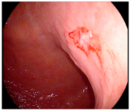 Cancers 14 05223 i001