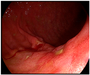 Cancers 14 05223 i002