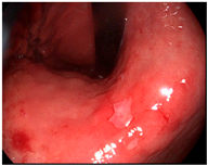 Cancers 14 05223 i003