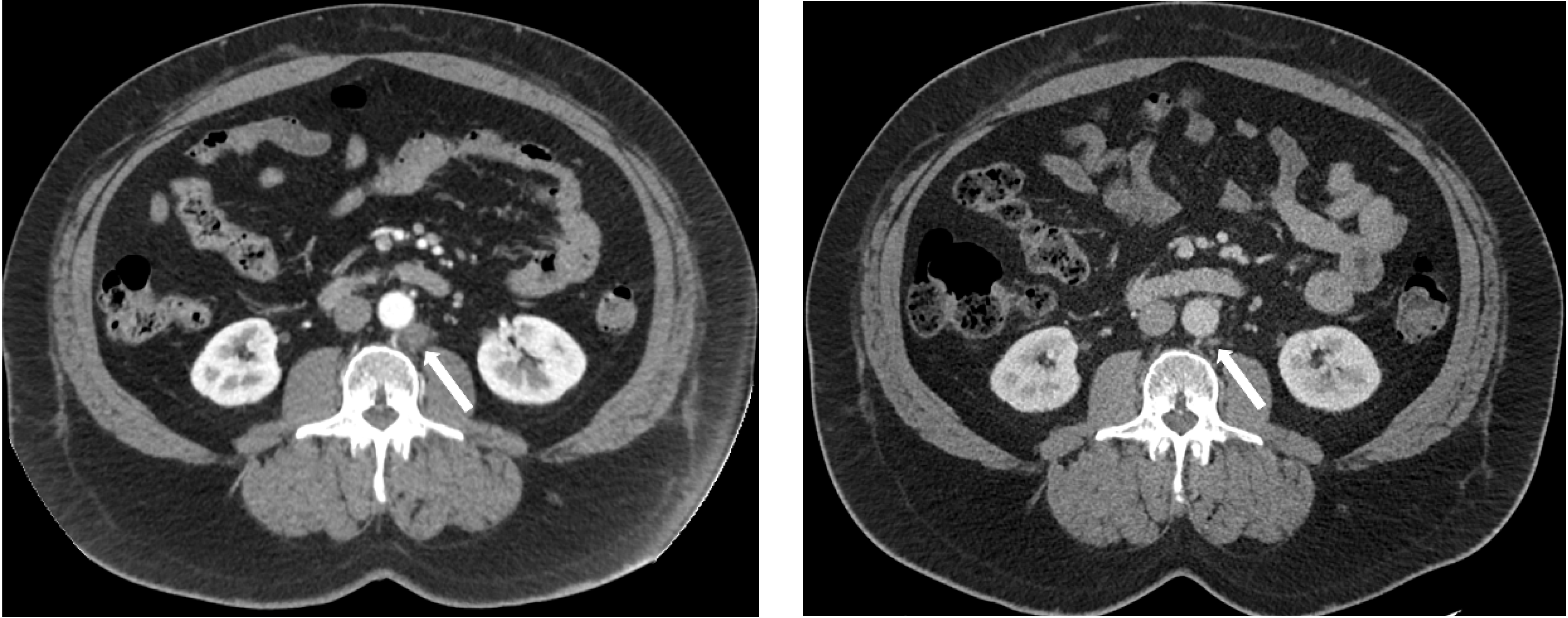 Cancers 14 05225 g002