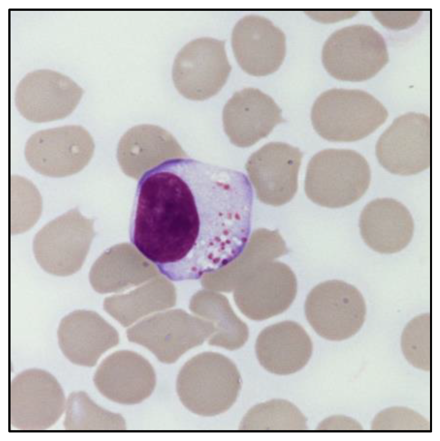 Cancers 14 05236 g001