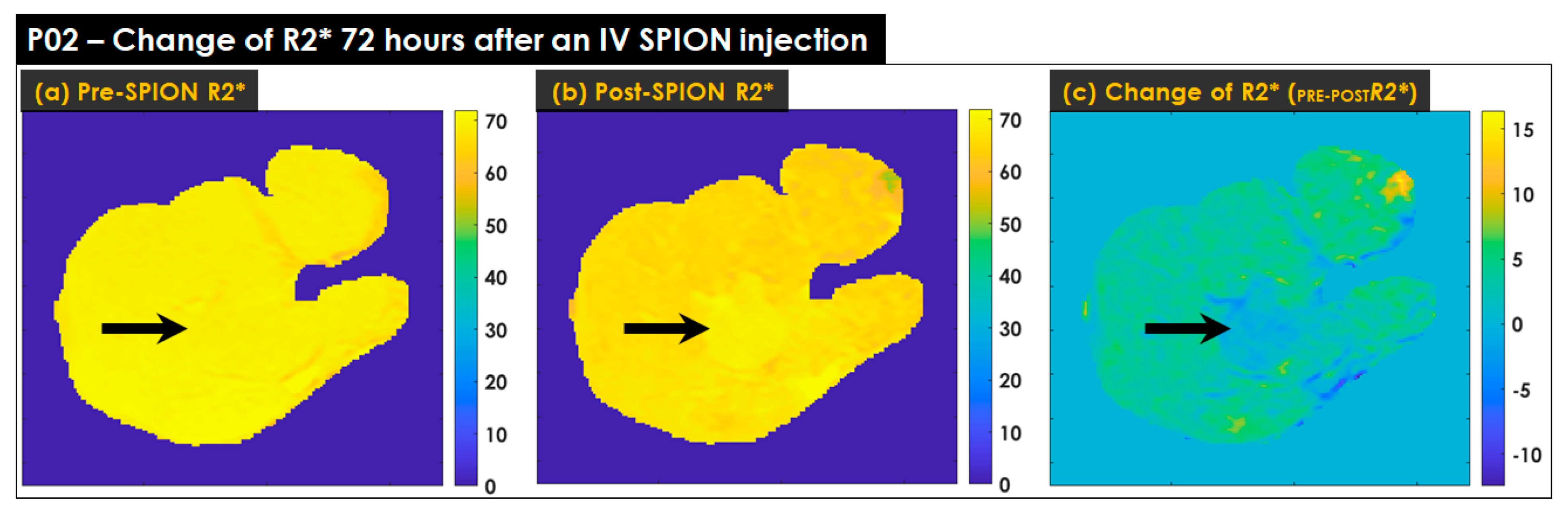Cancers 14 05269 g005
