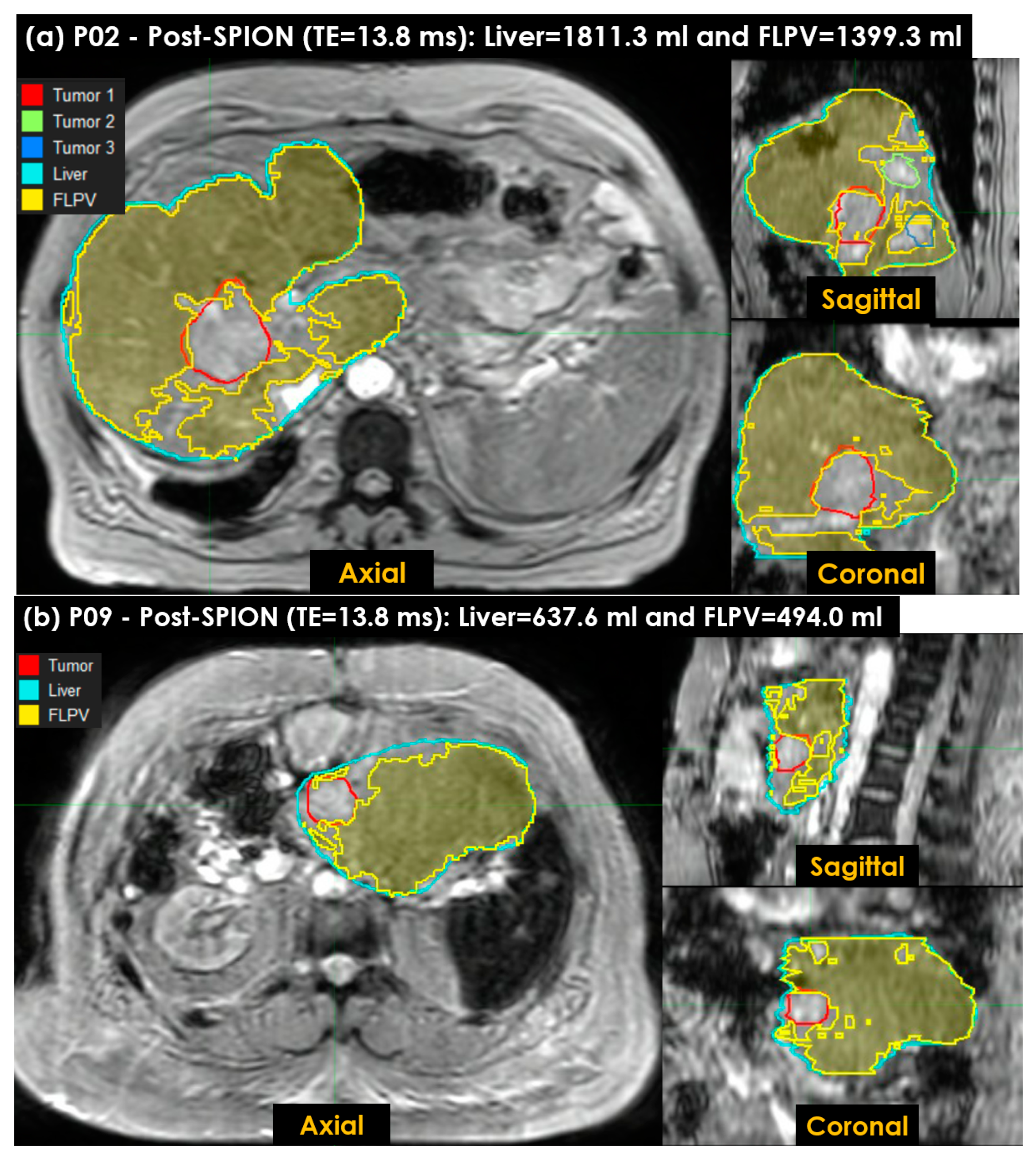 Cancers 14 05269 g008