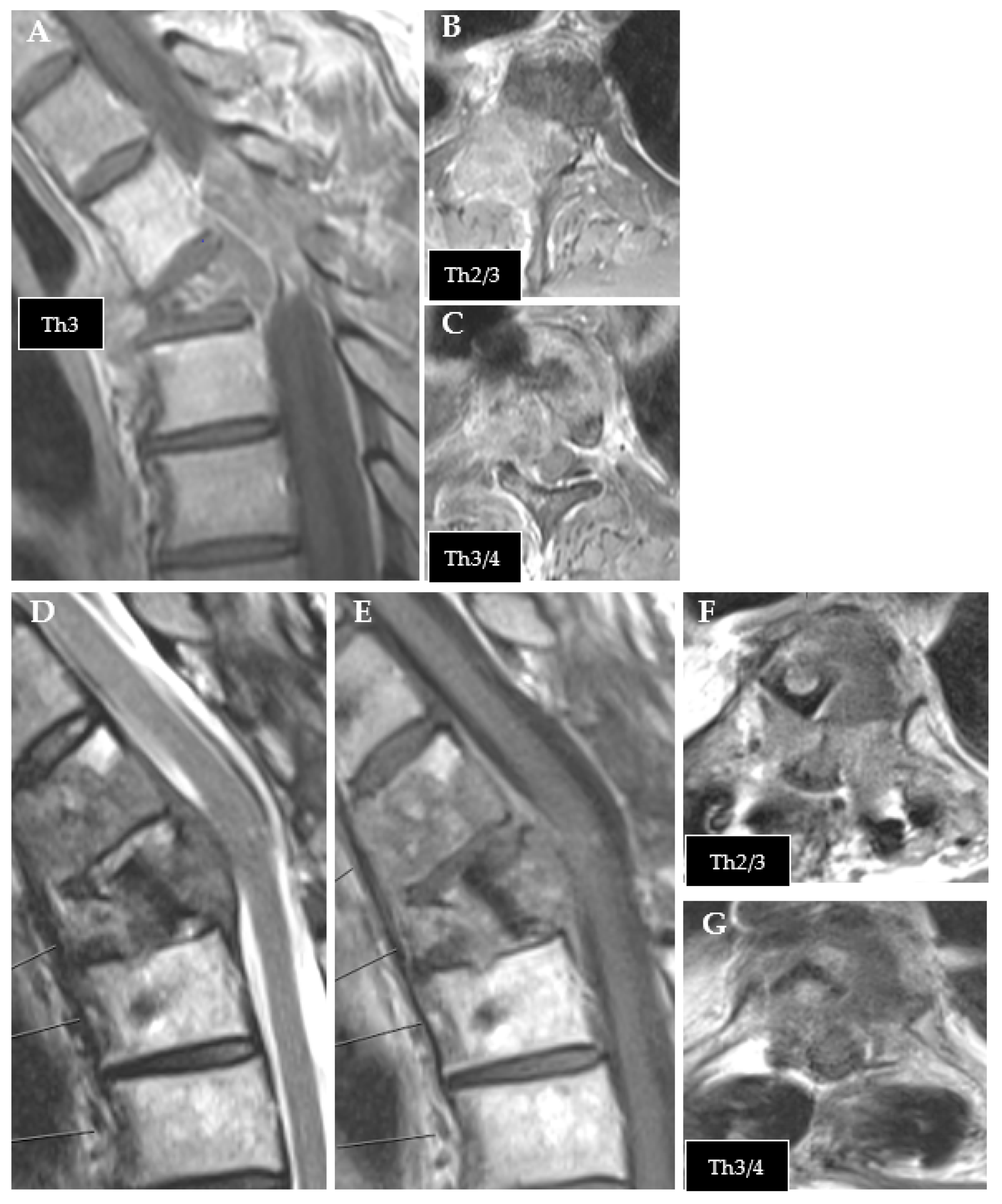 Cancers 14 05275 g001