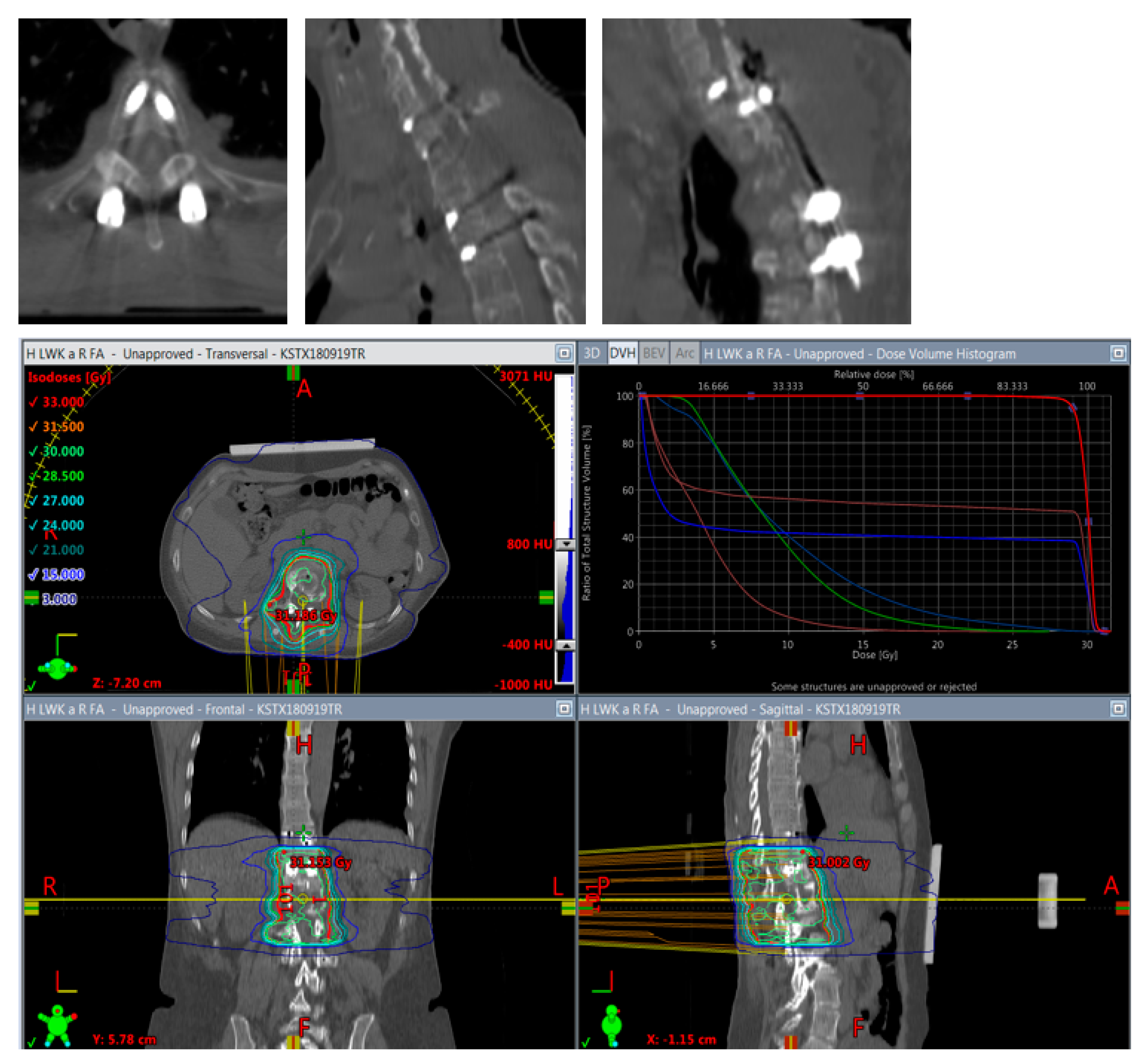 Cancers 14 05275 g005