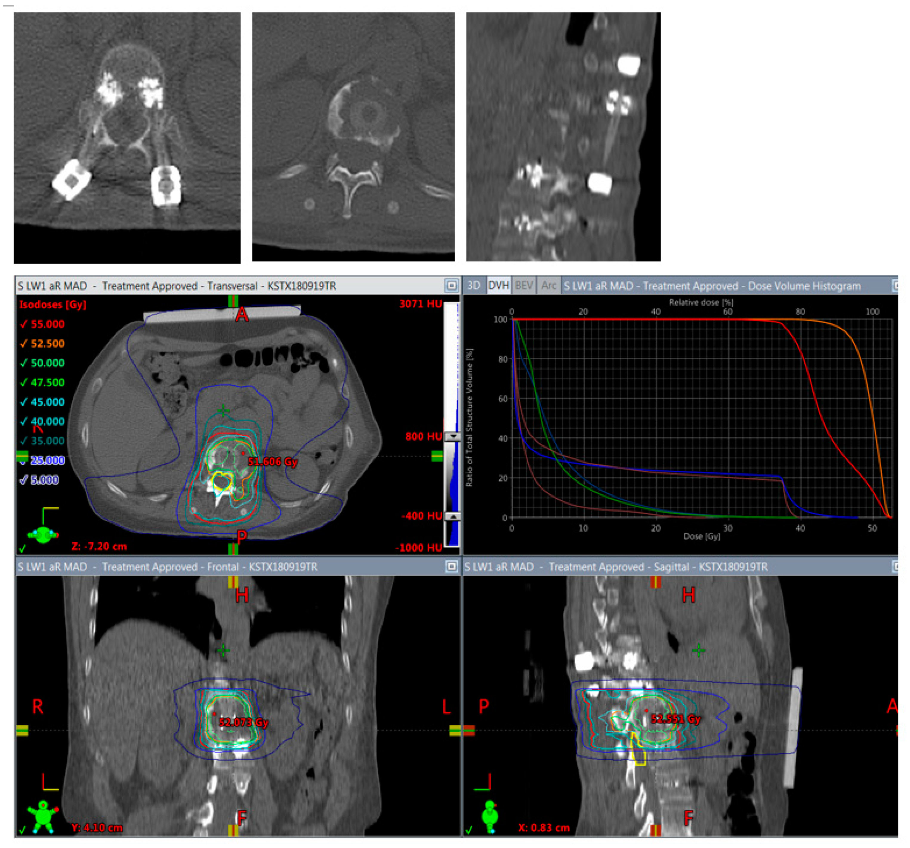 Cancers 14 05275 g006