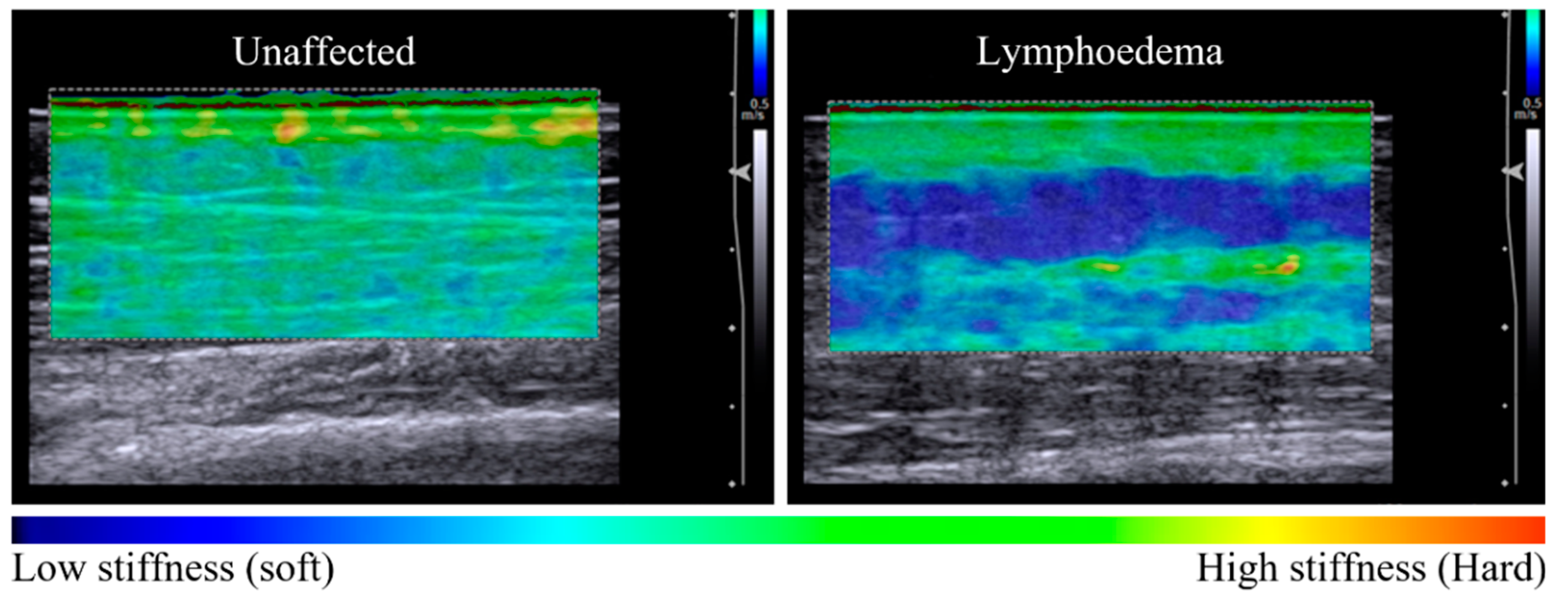 Cancers 14 05281 g001