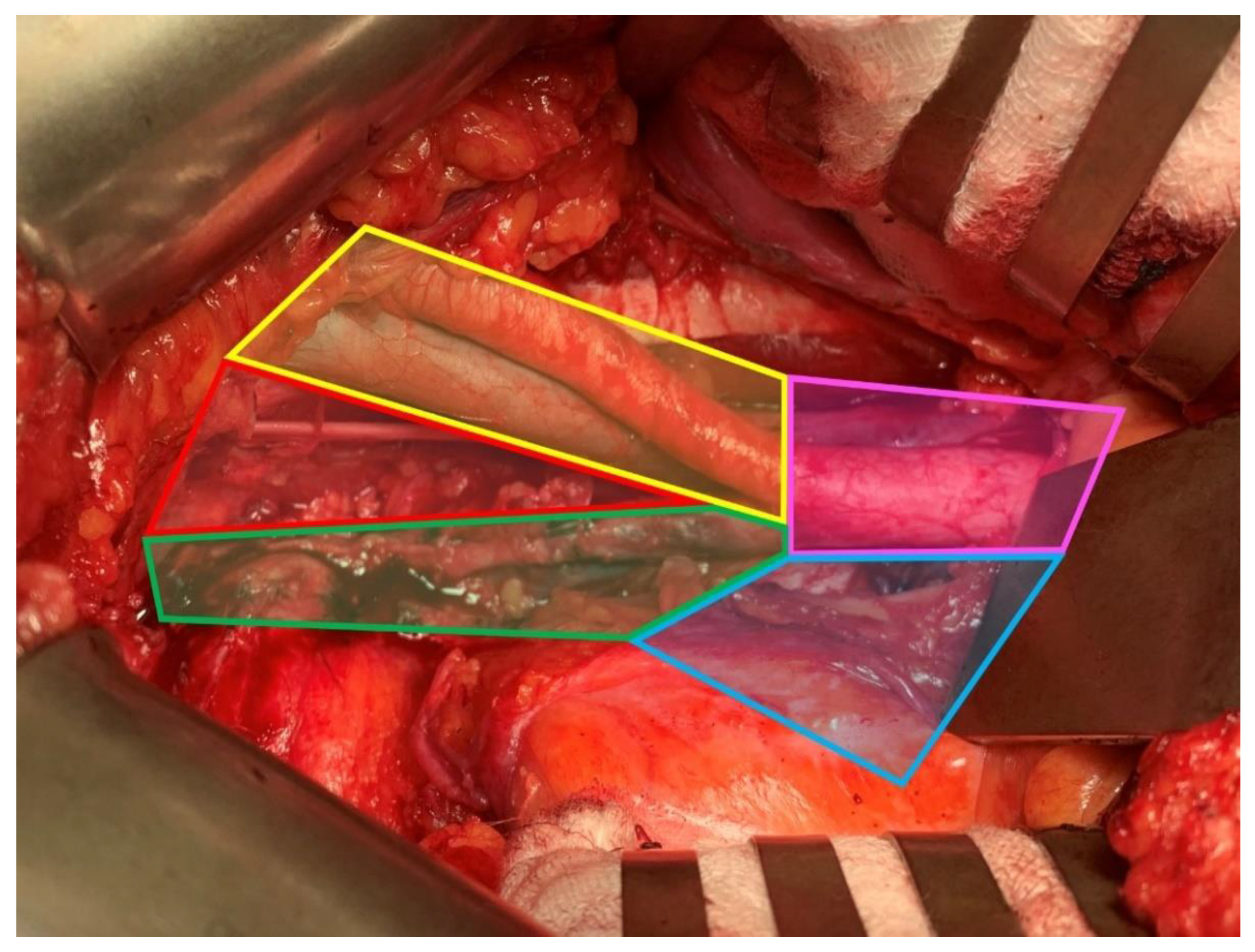 Cancers 14 05286 g002