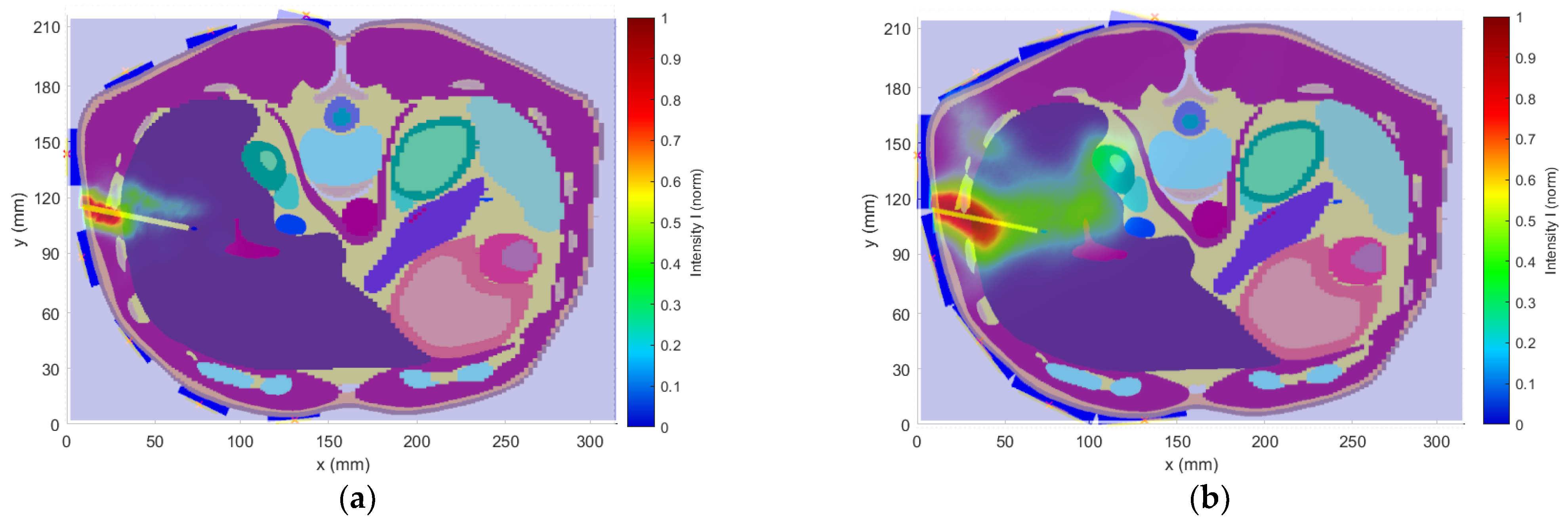 Cancers 14 05296 g016
