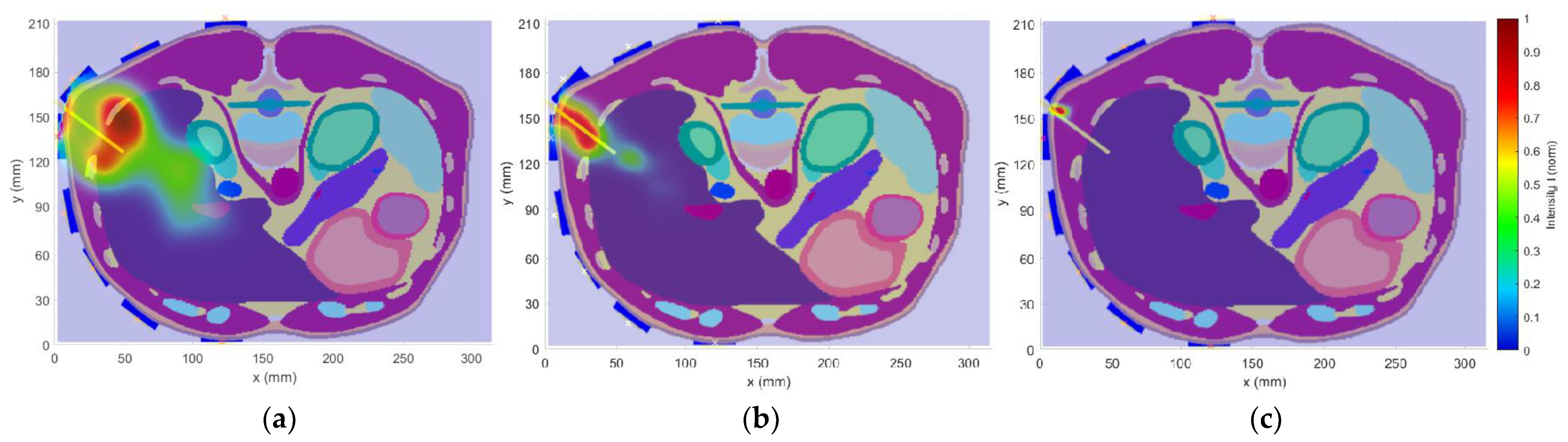 Cancers 14 05296 g017