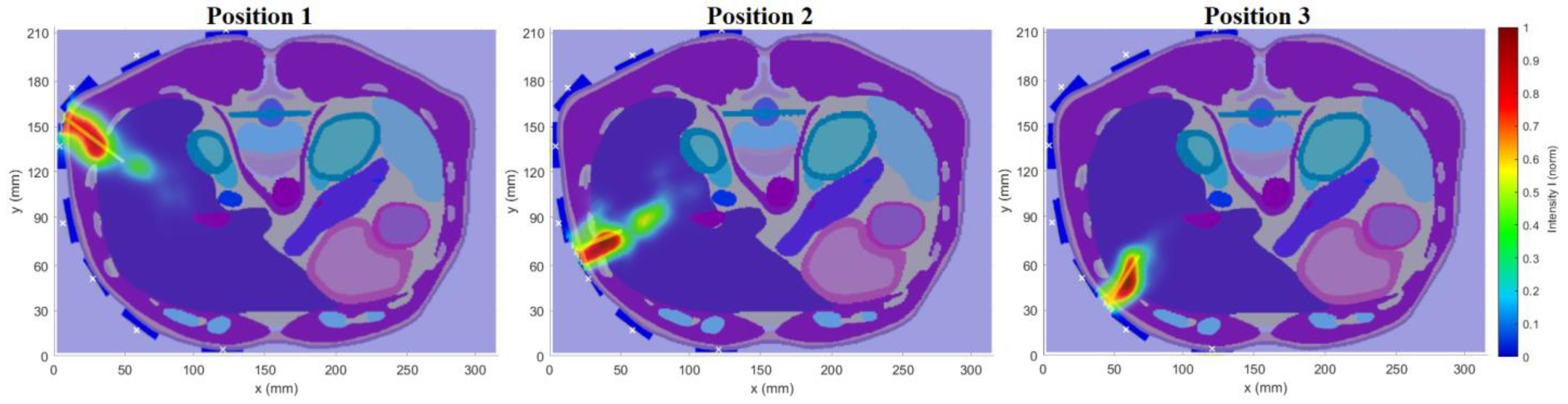 Cancers 14 05296 g018