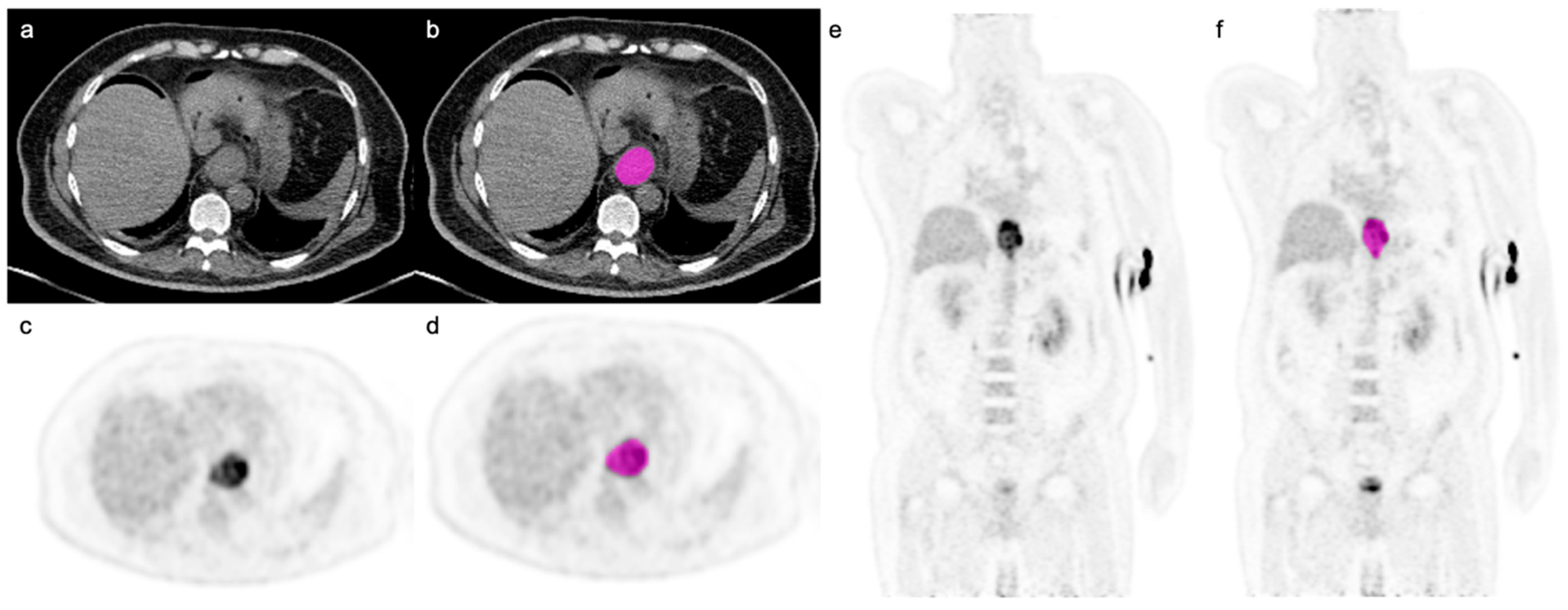 Cancers 14 05314 g001