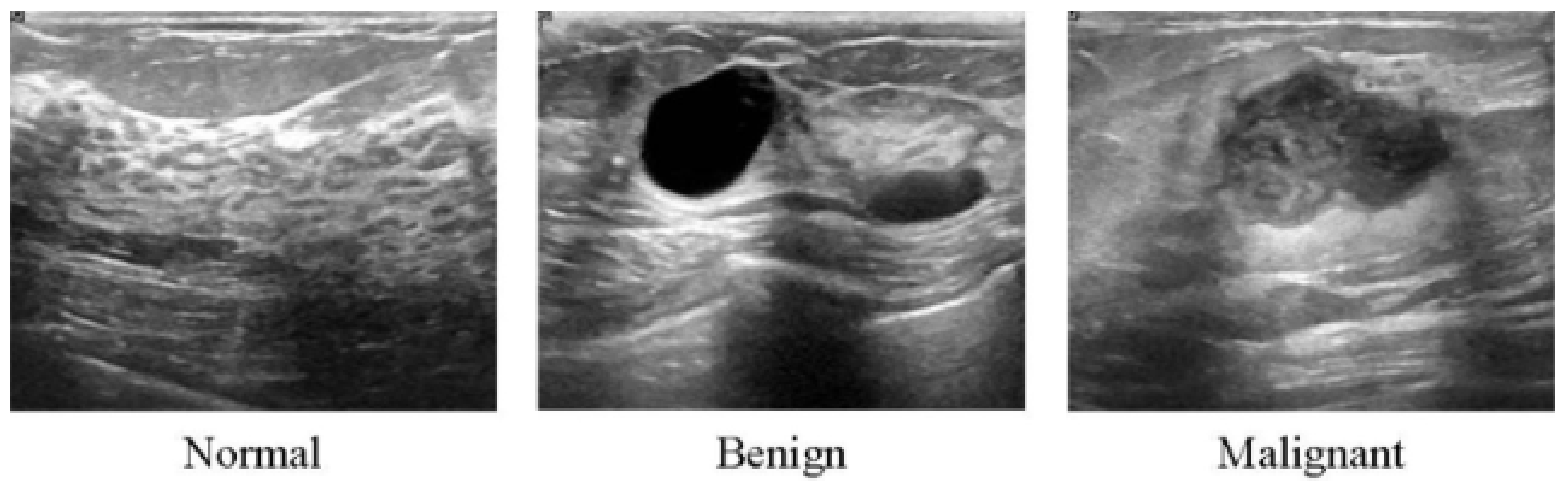 Cancers 14 05334 g003 Cancers 14 05334 g003