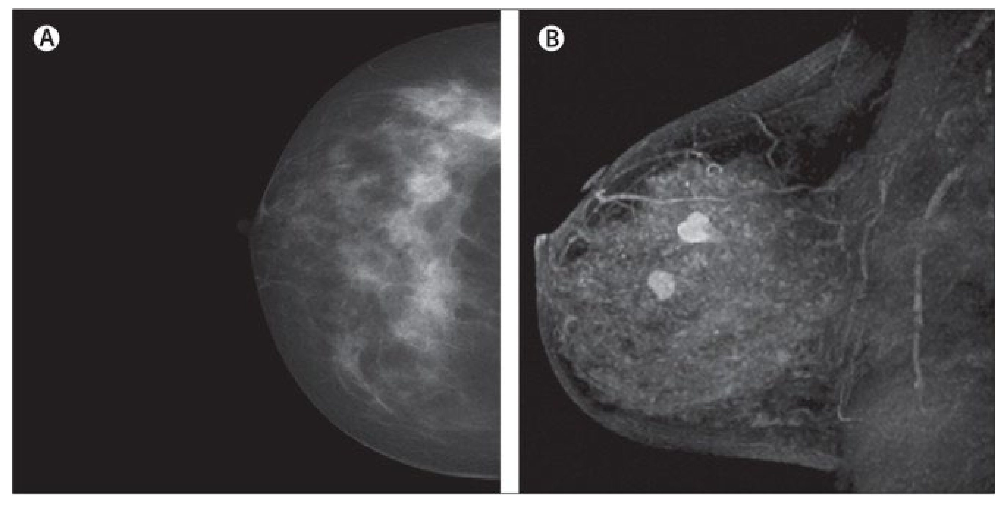 Cancers 14 05334 g004 Cancers 14 05334 g004