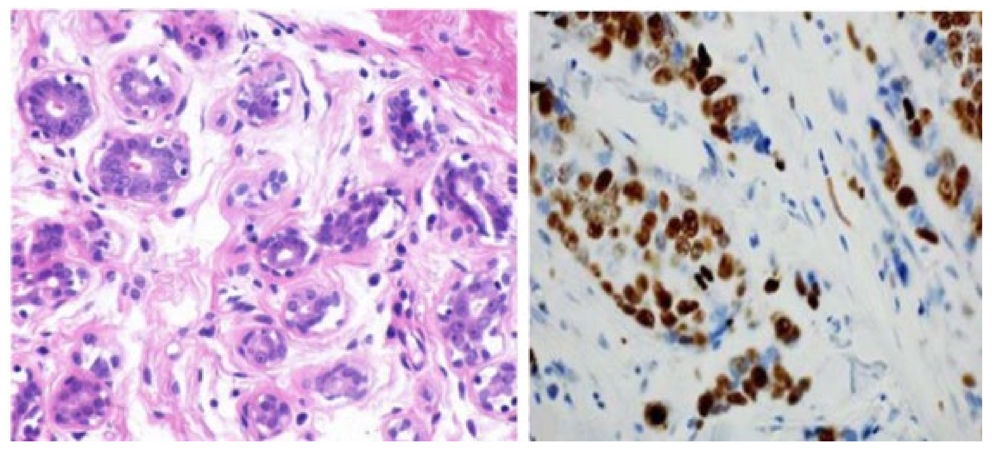 Cancers 14 05334 g005 Cancers 14 05334 g005