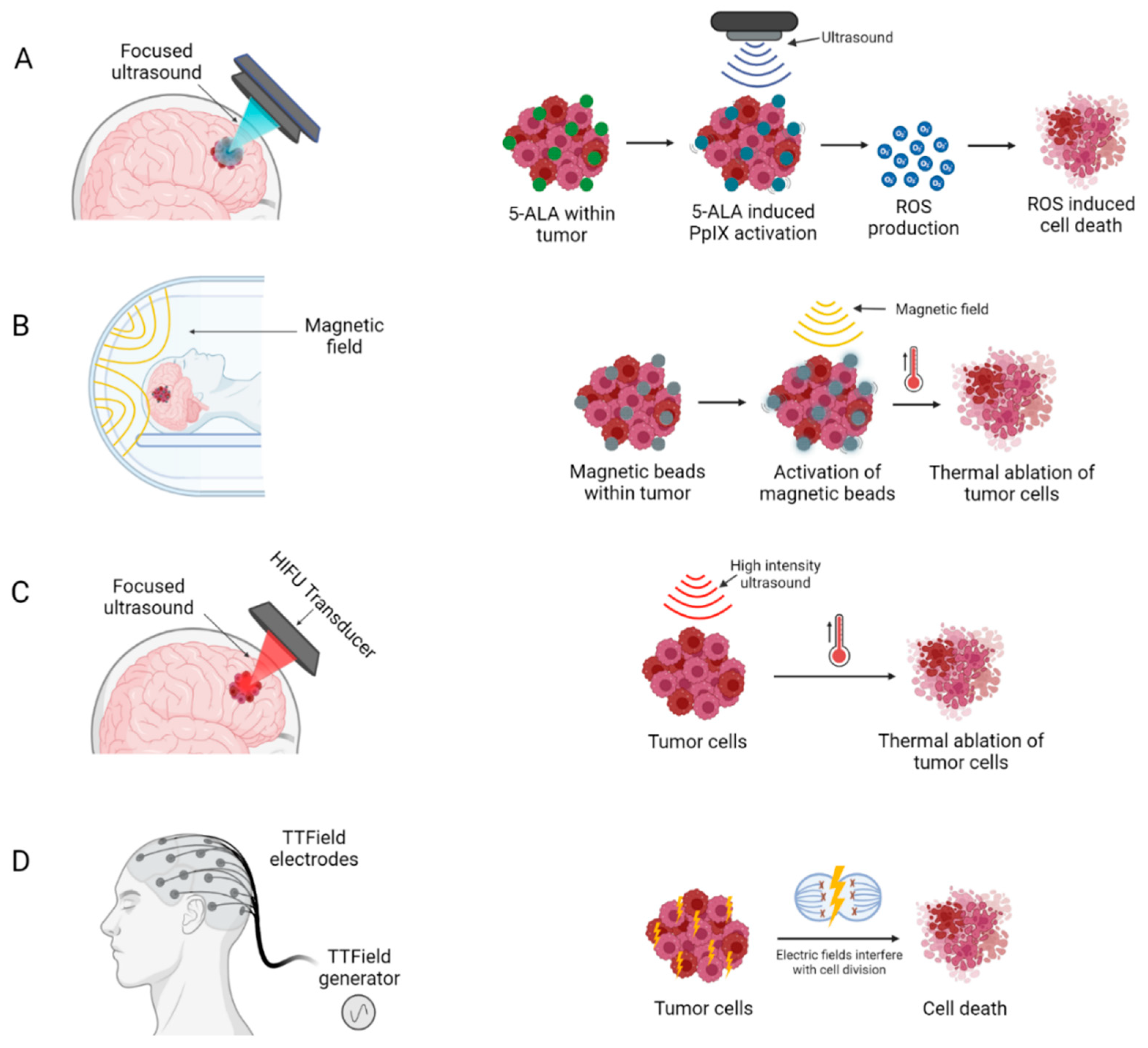 Cancers 14 05341 g004