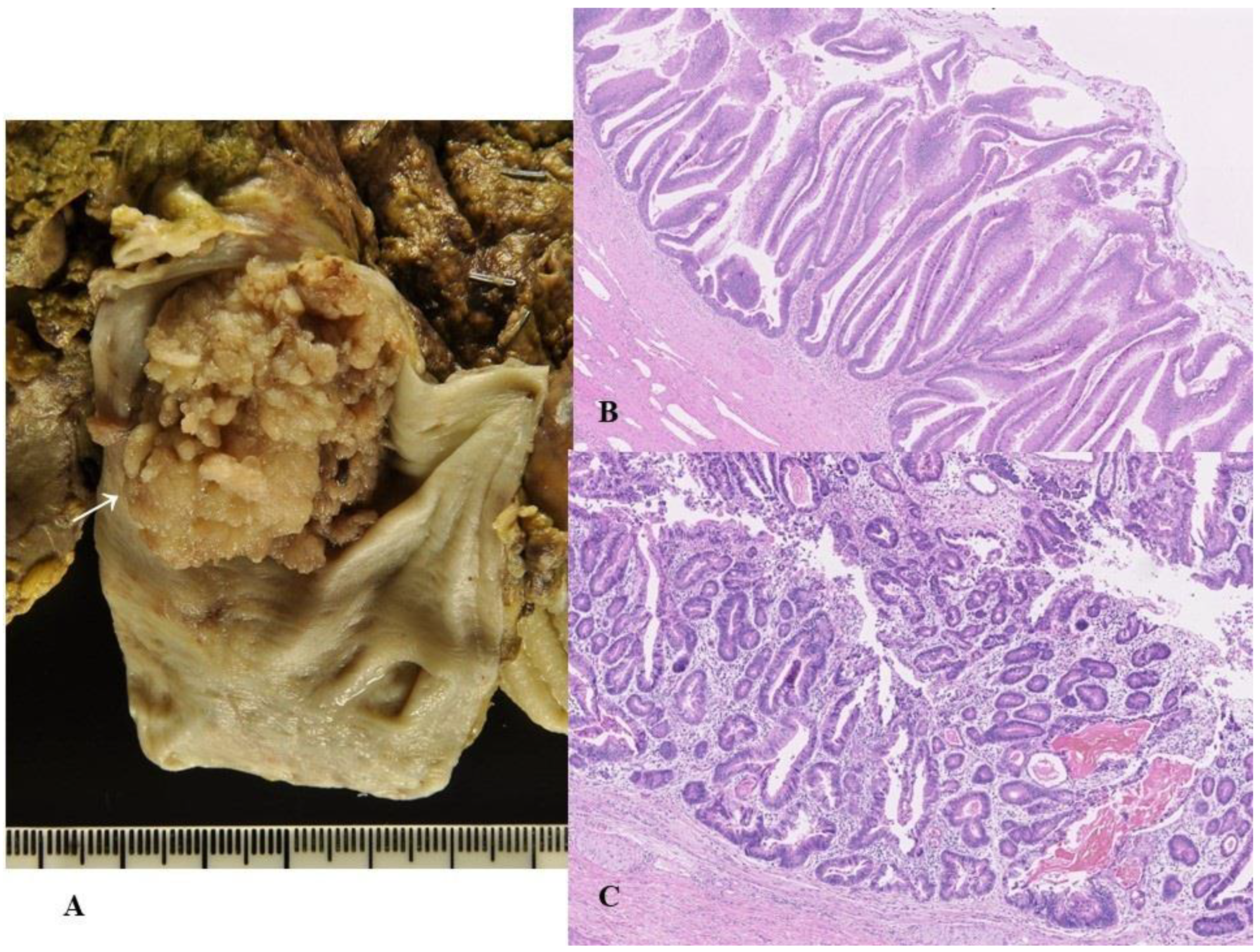 Cancers 14 05358 g002 Cancers 14 05358 g002