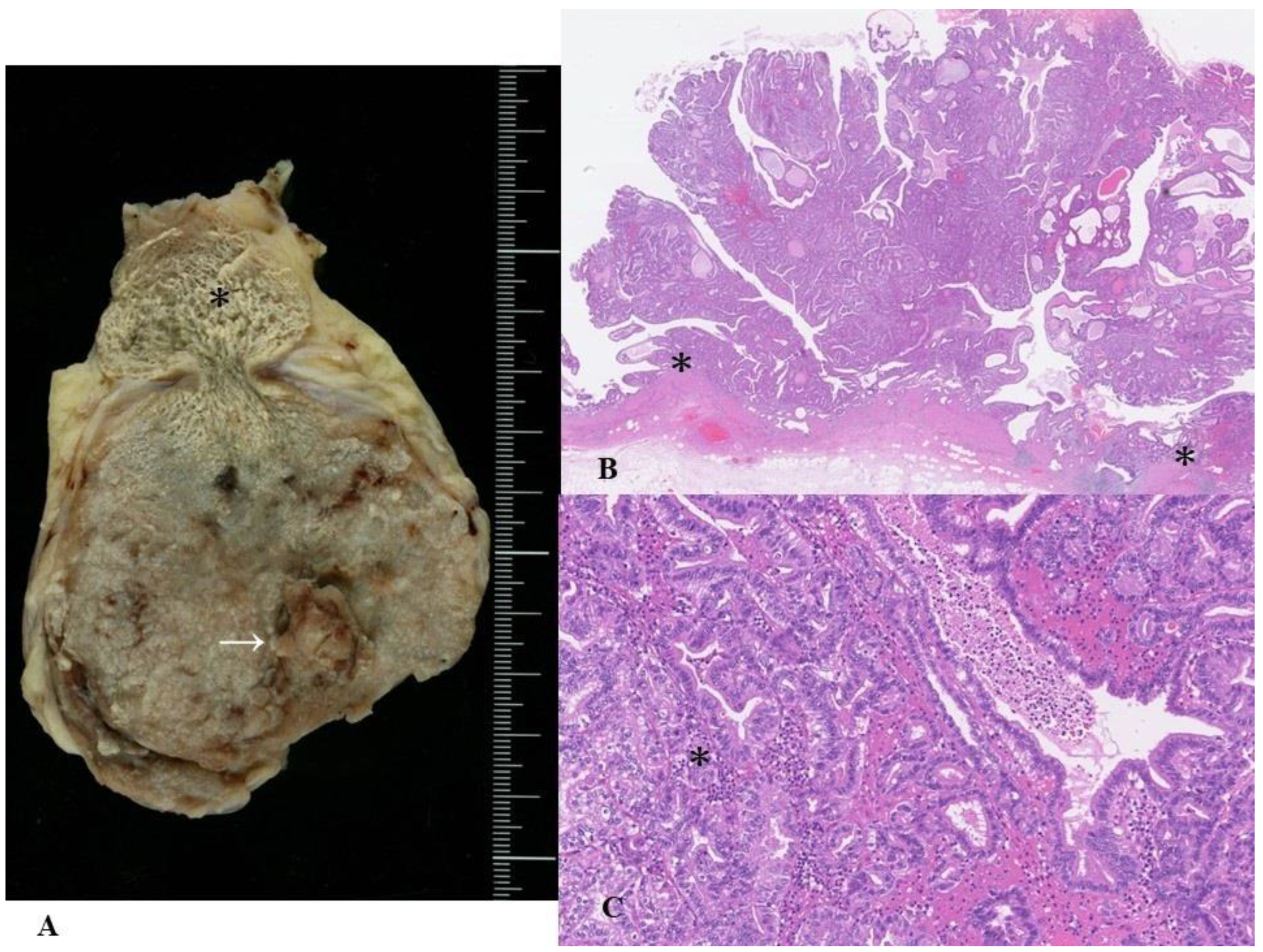 Cancers 14 05358 g003 Cancers 14 05358 g003