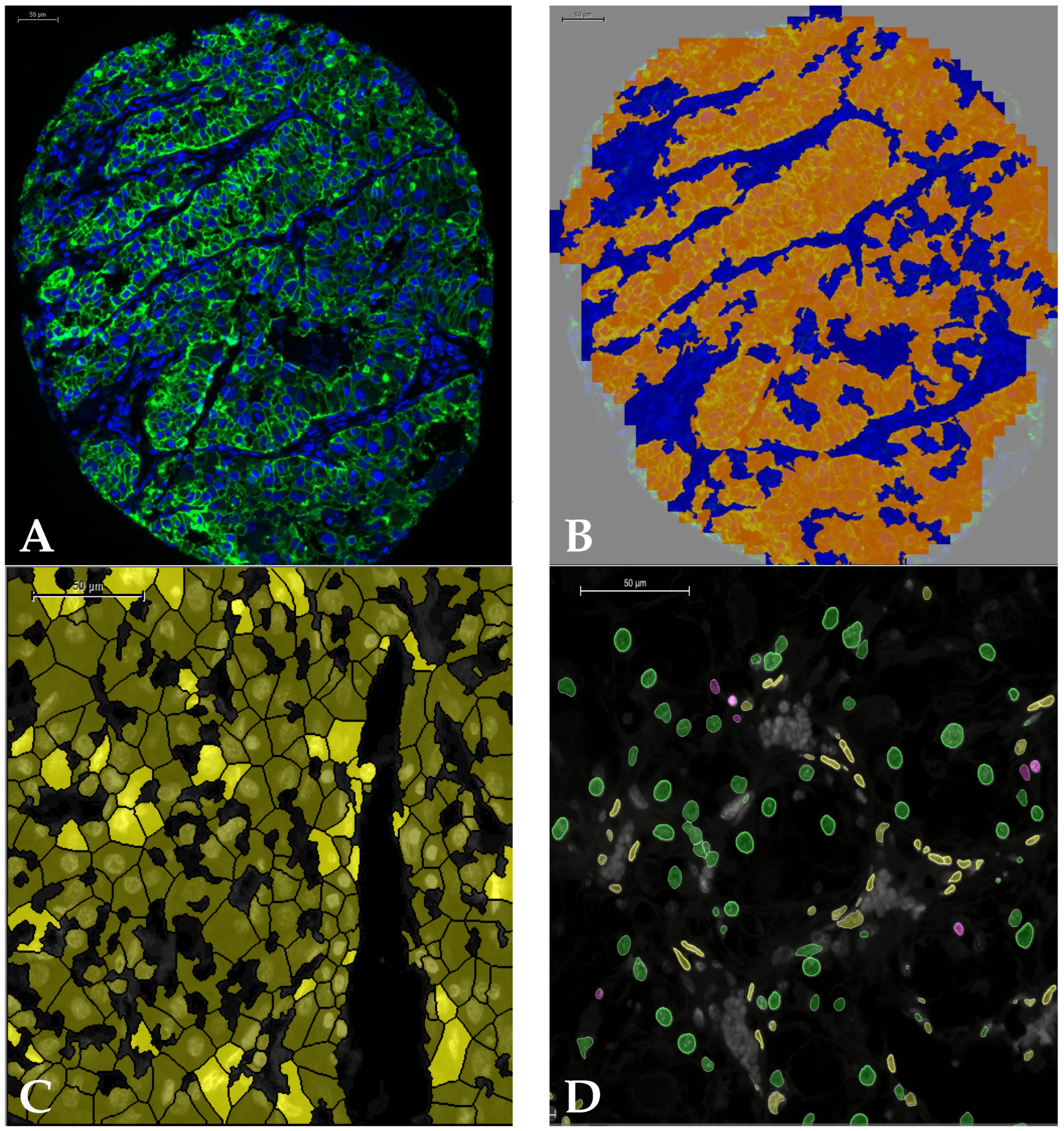 Cancers 14 05387 g002