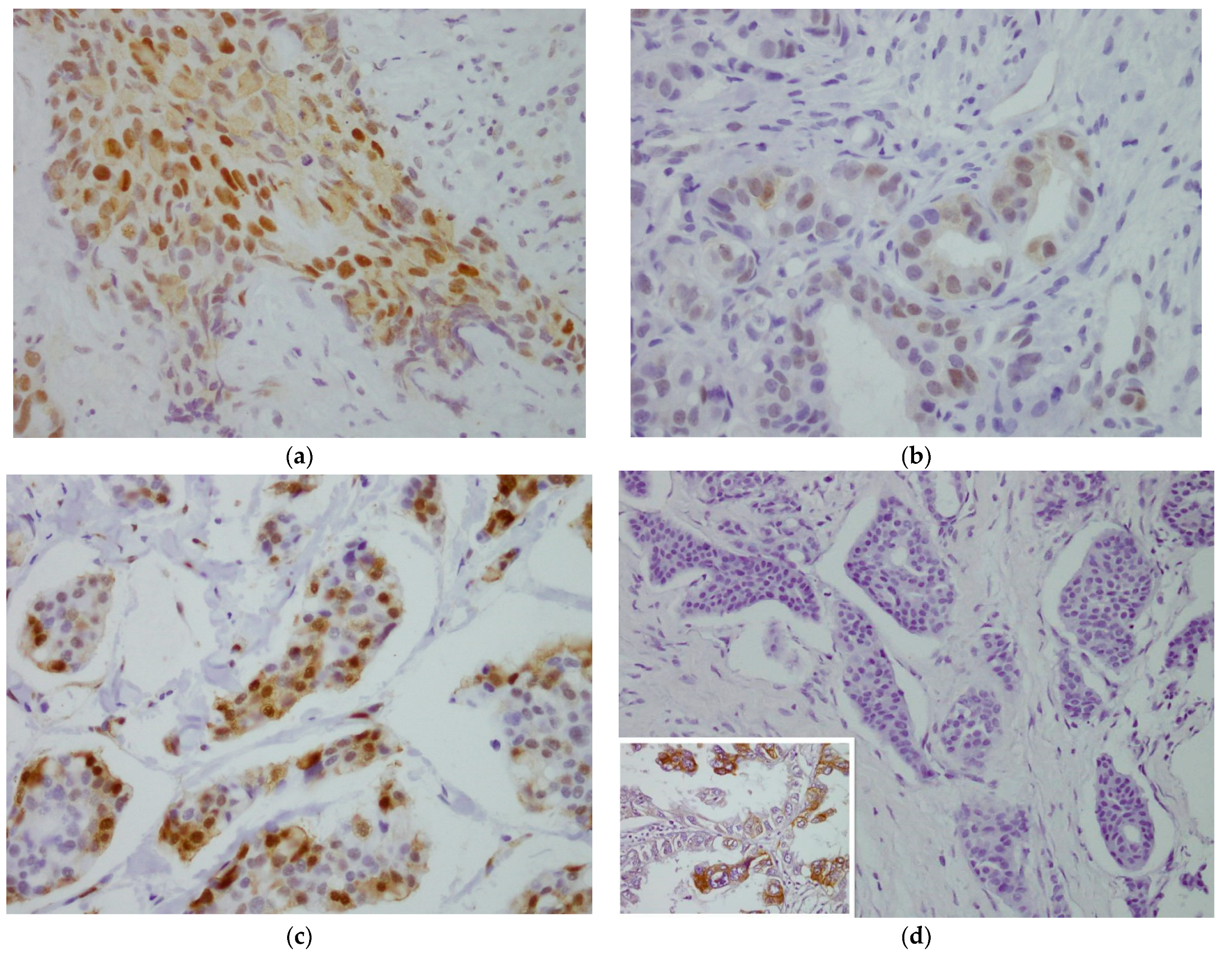 Cancers 14 05393 g001 Cancers 14 05393 g001