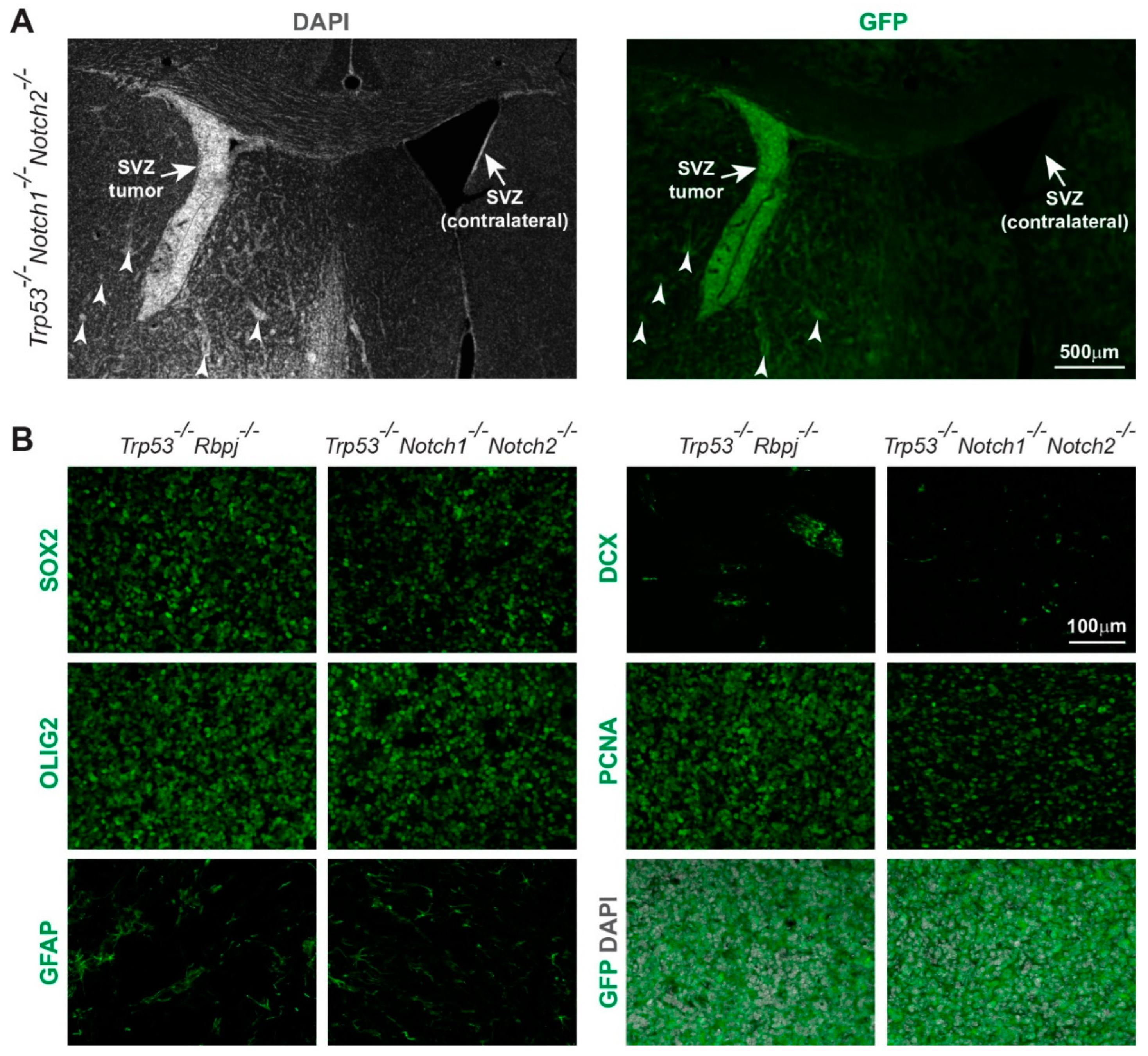 Cancers 14 05409 g002