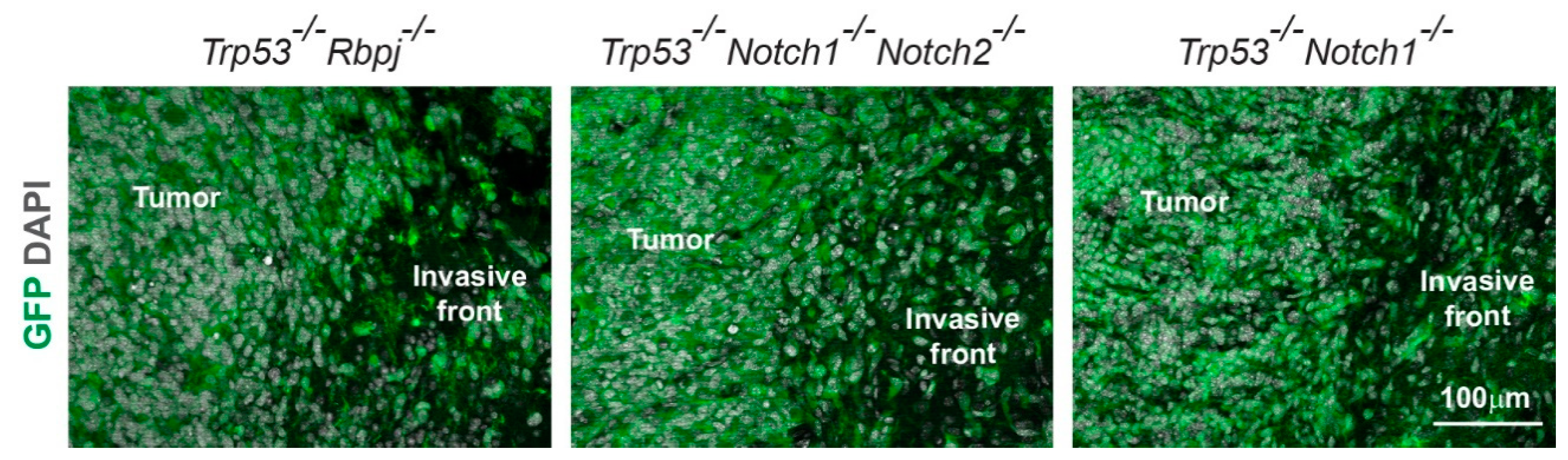 Cancers 14 05409 g004