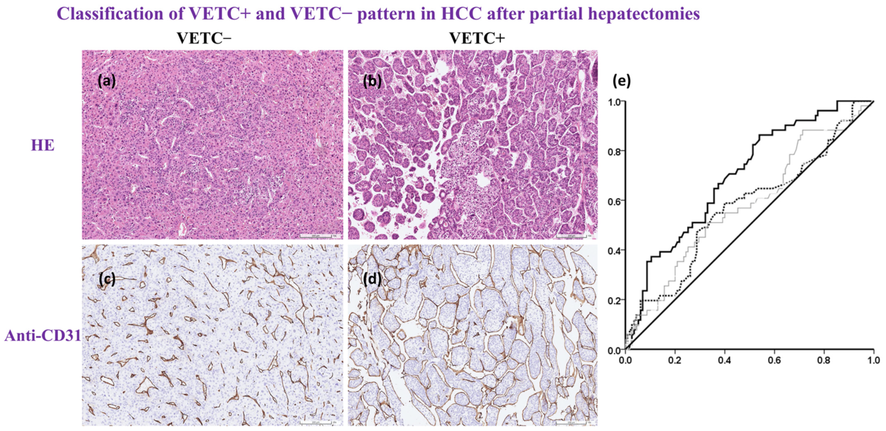 Cancers 14 05428 g002 Cancers 14 05428 g002