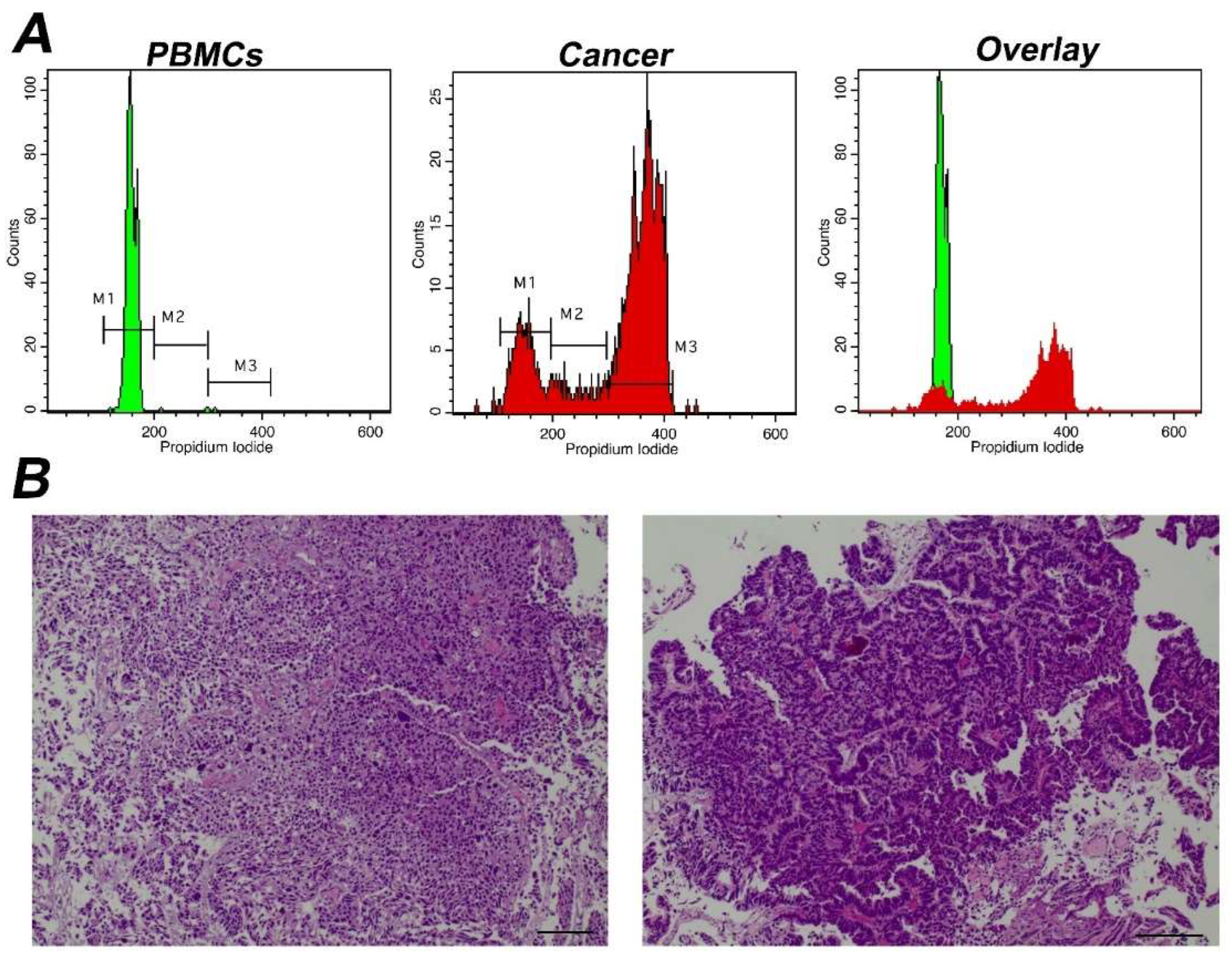 Cancers 14 05440 g003