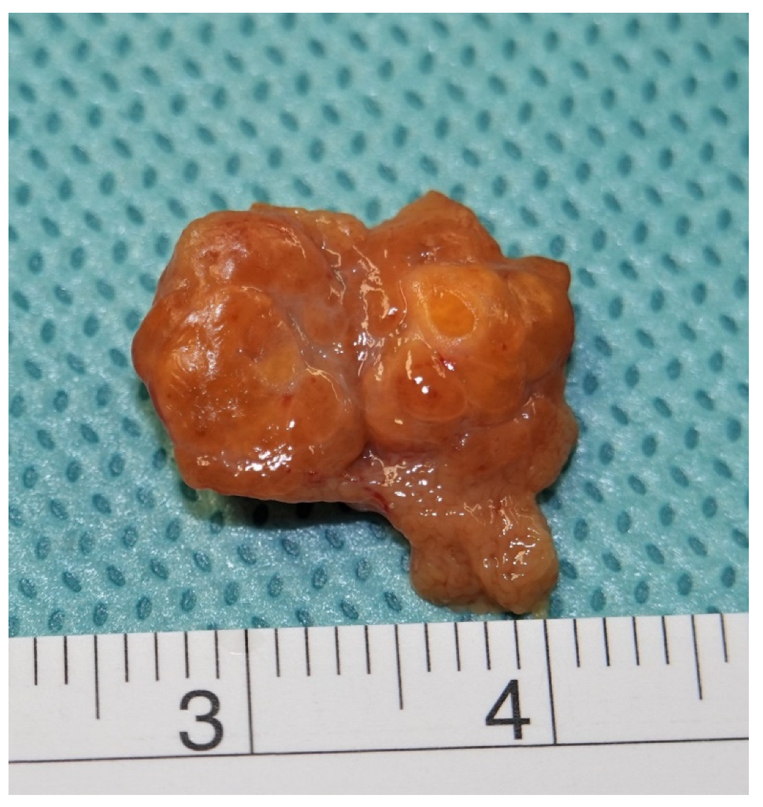 Cancers 14 05447 g002 Cancers 14 05447 g002