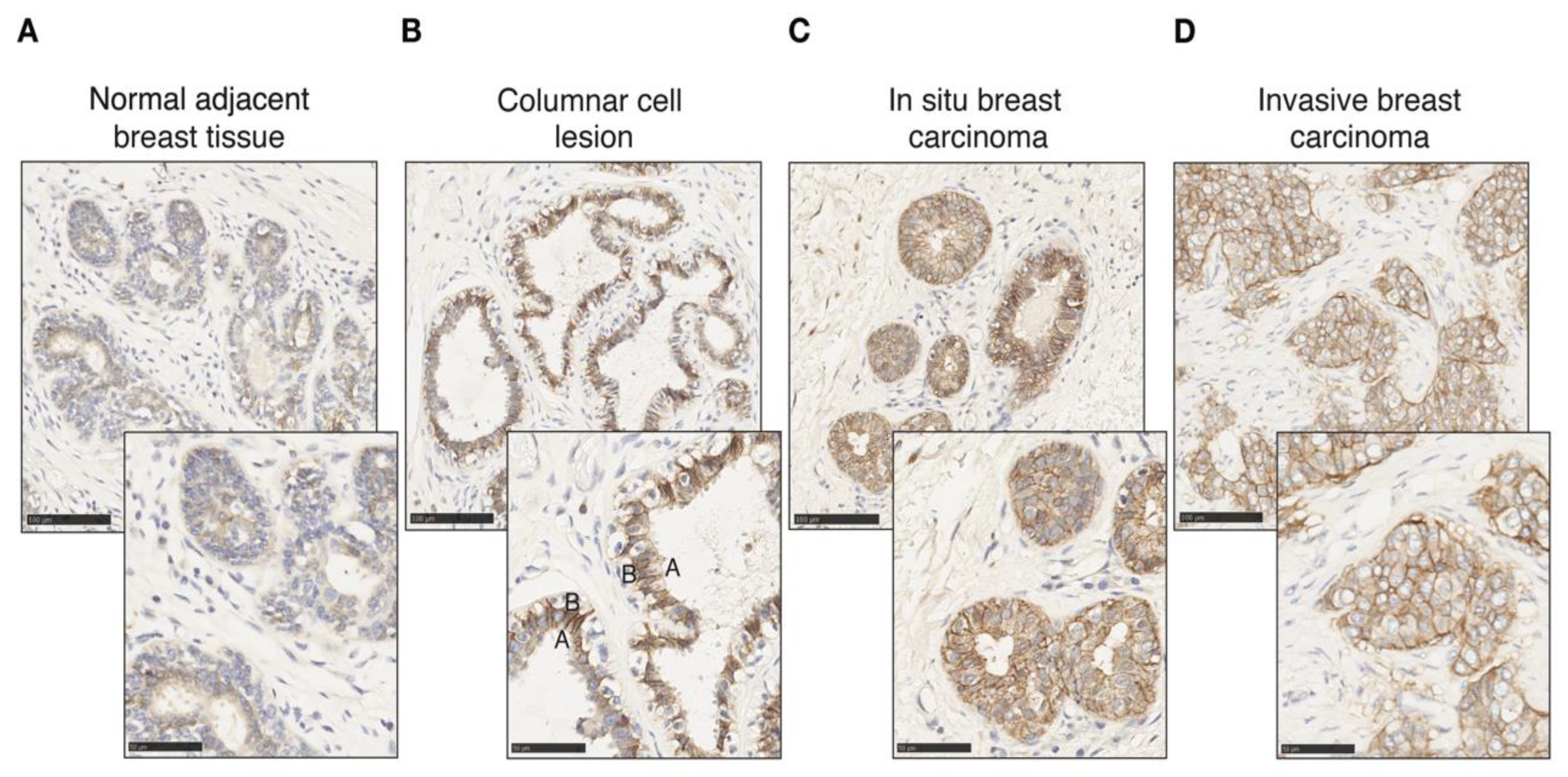 Cancers 14 05453 g005