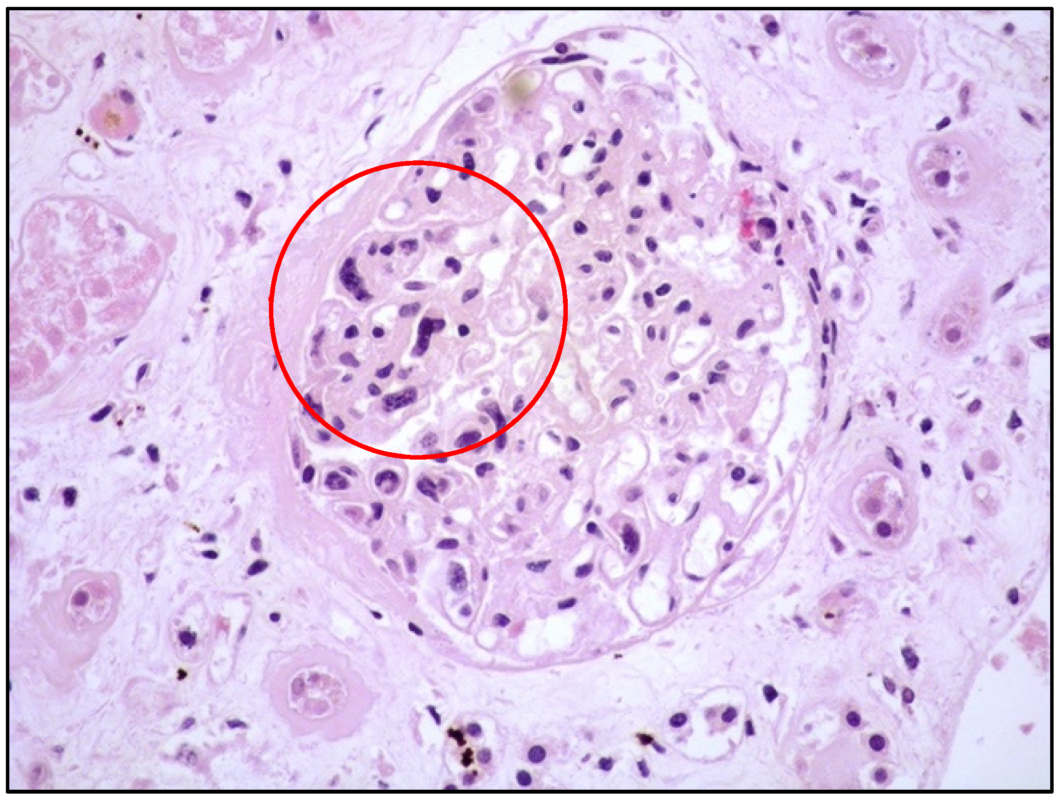 Cancers 14 05458 g001 Cancers 14 05458 g001