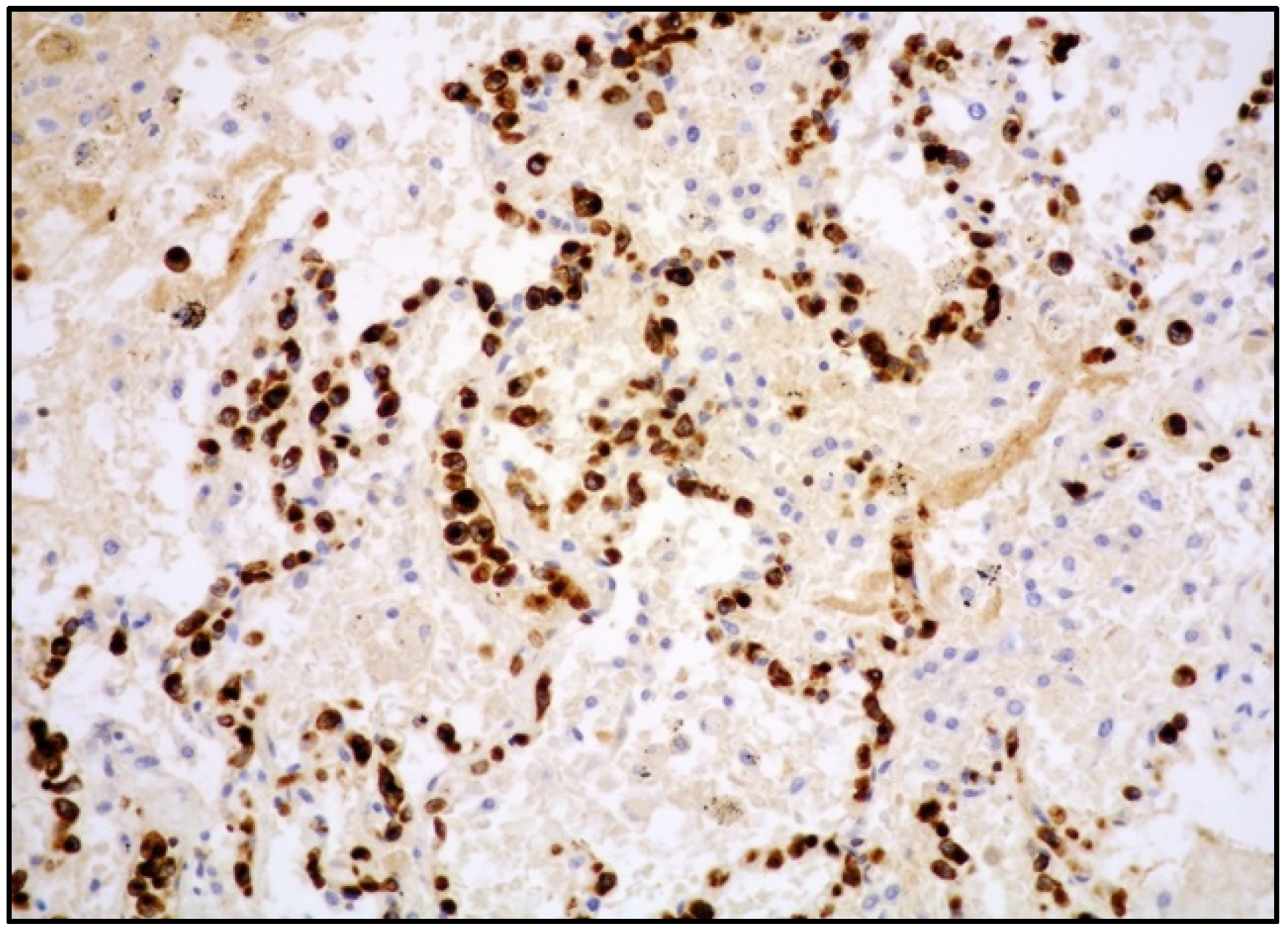 Cancers 14 05458 g004 Cancers 14 05458 g004