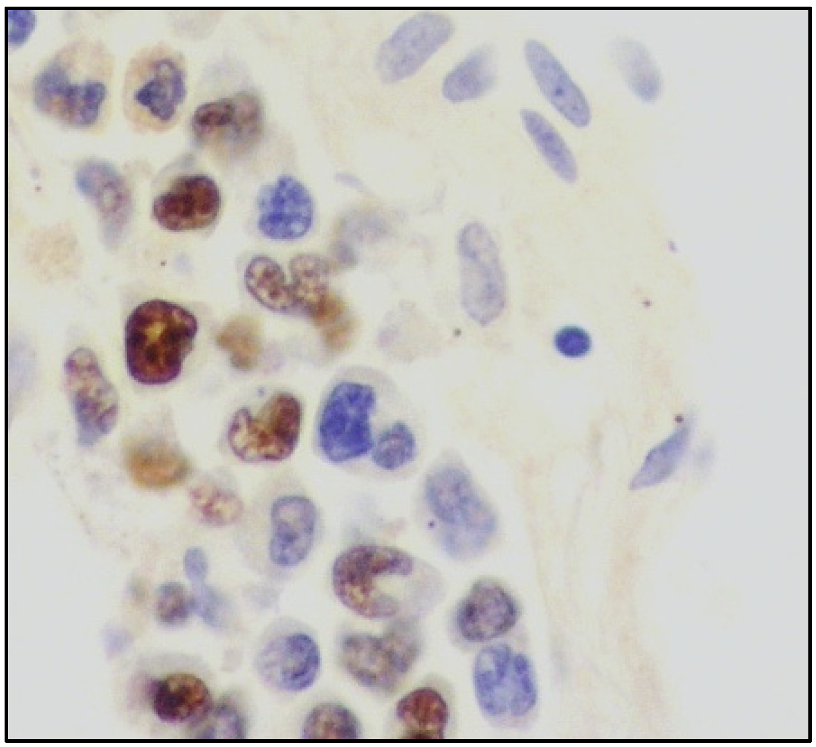 Cancers 14 05458 g005 Cancers 14 05458 g005