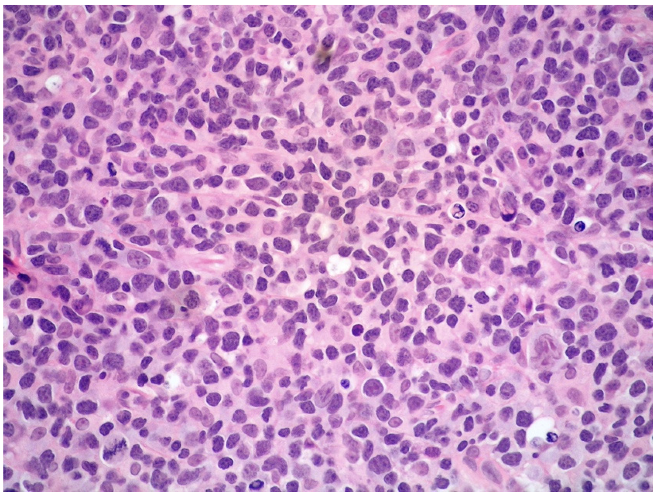 Cancers 14 05458 g006 Cancers 14 05458 g006