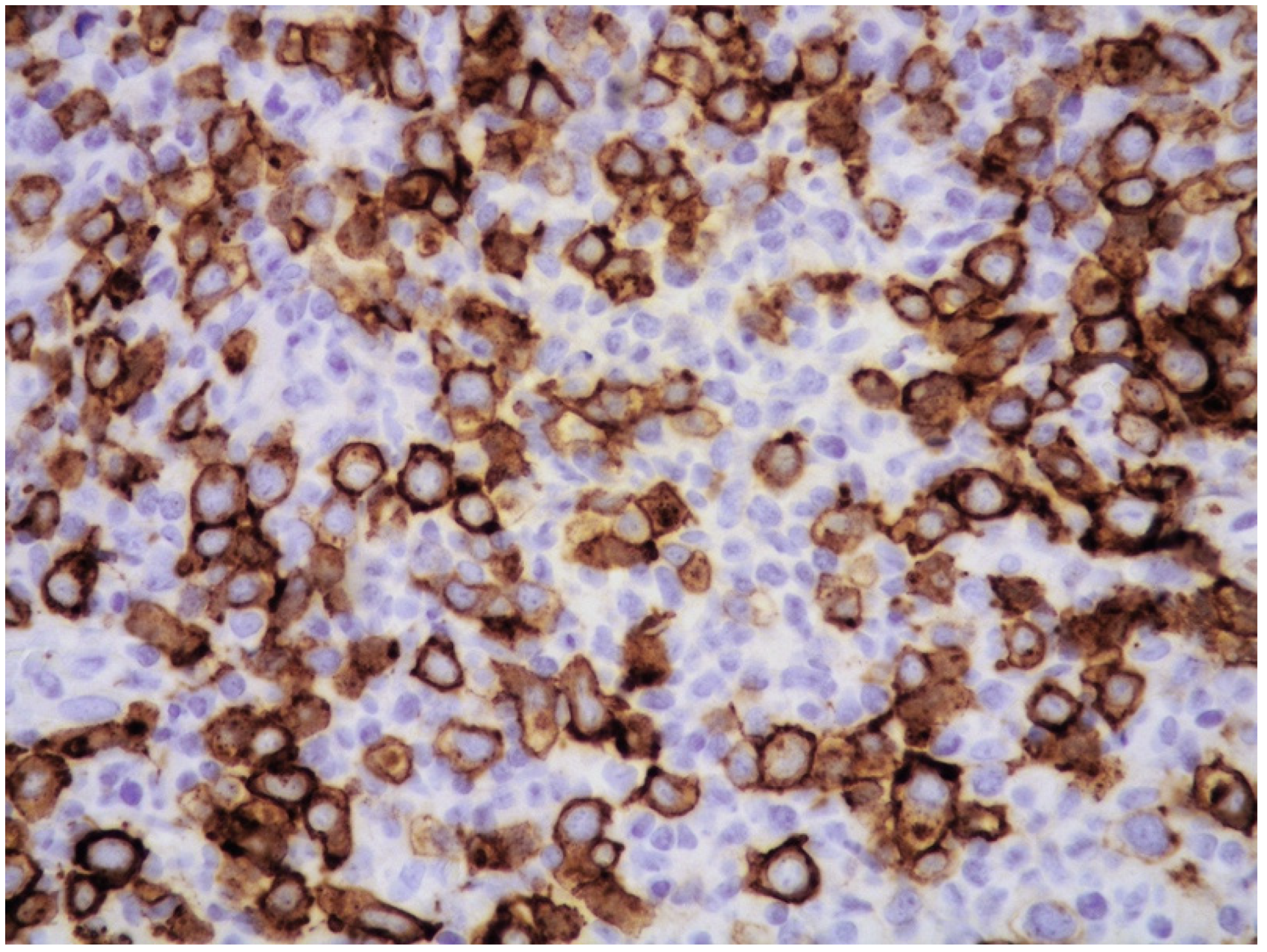 Cancers 14 05458 g008 Cancers 14 05458 g008