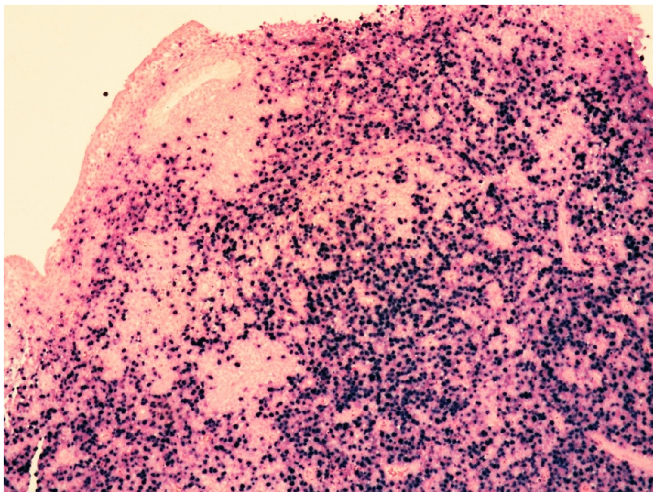 Cancers 14 05458 g009 Cancers 14 05458 g009