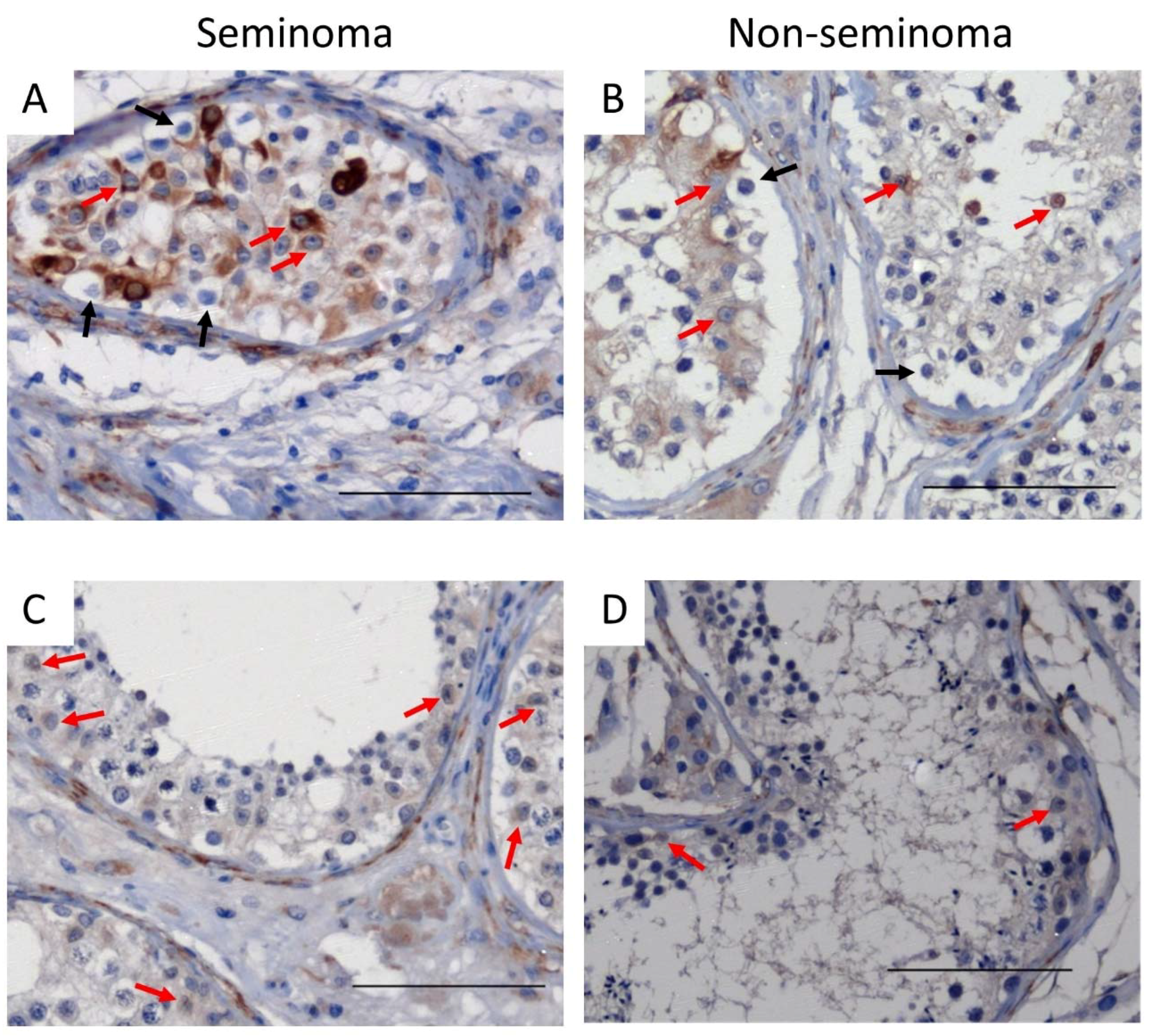 Cancers 14 05479 g004 Cancers 14 05479 g004