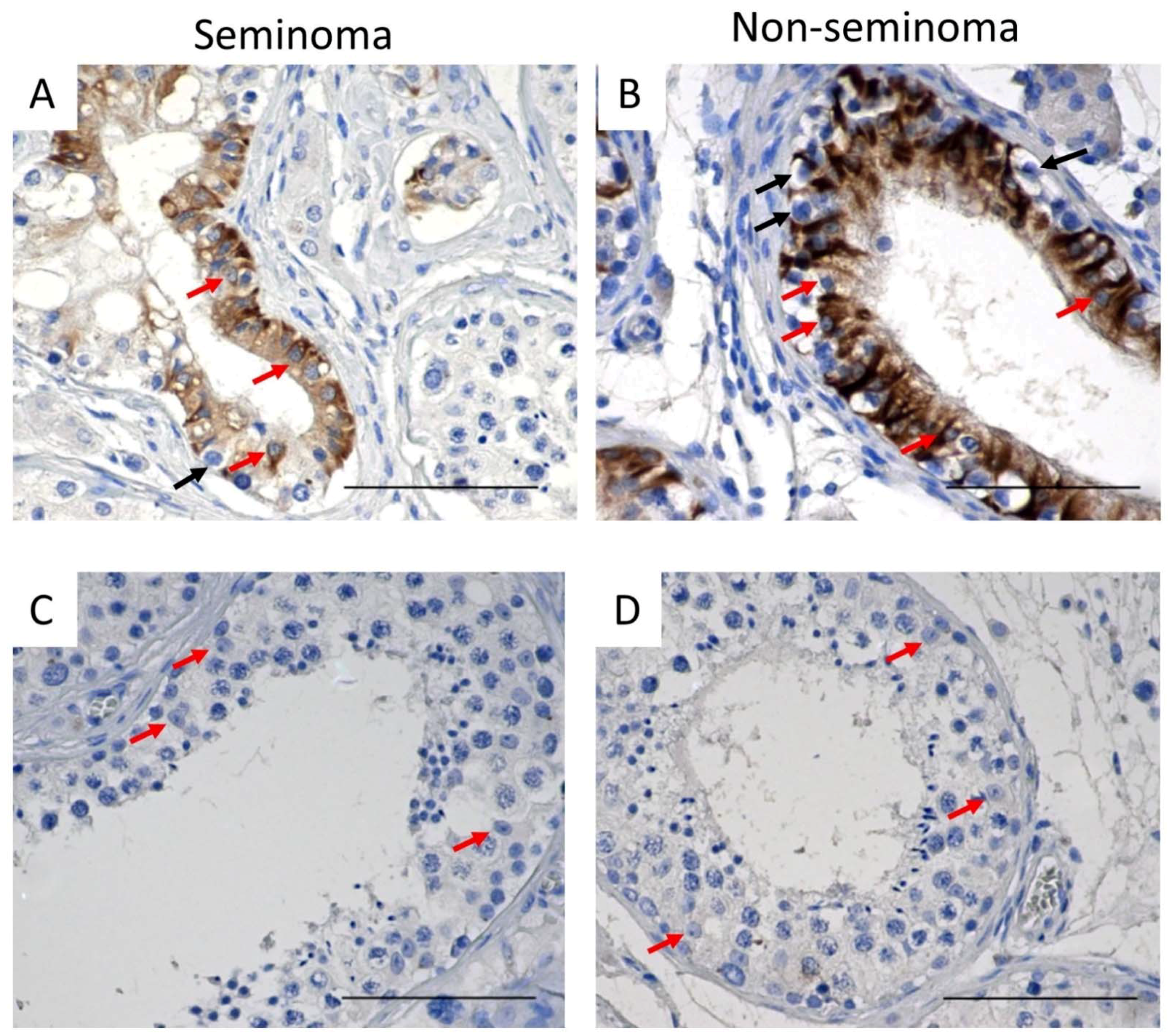 Cancers 14 05479 g005 Cancers 14 05479 g005
