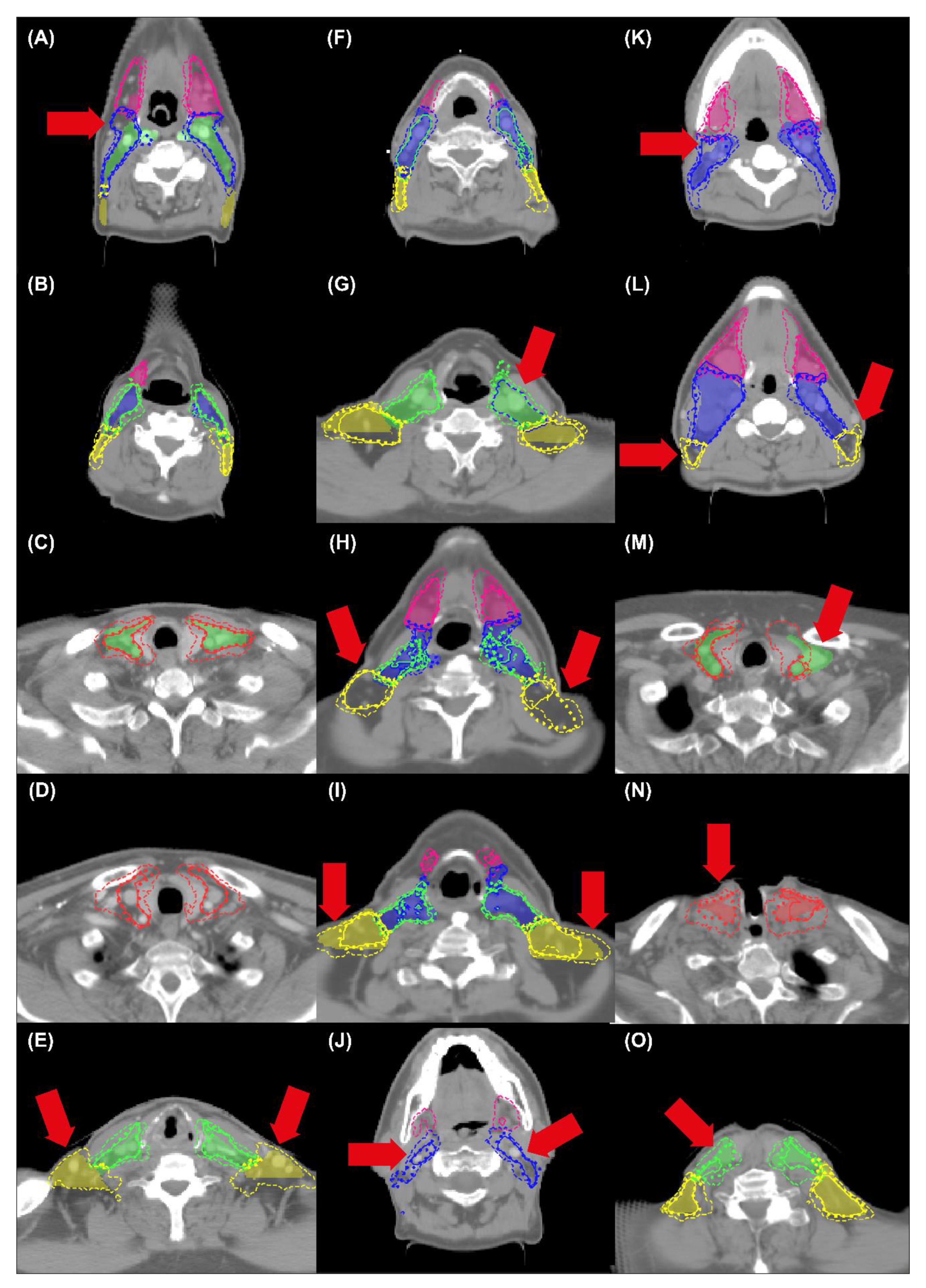 Cancers 14 05501 g006