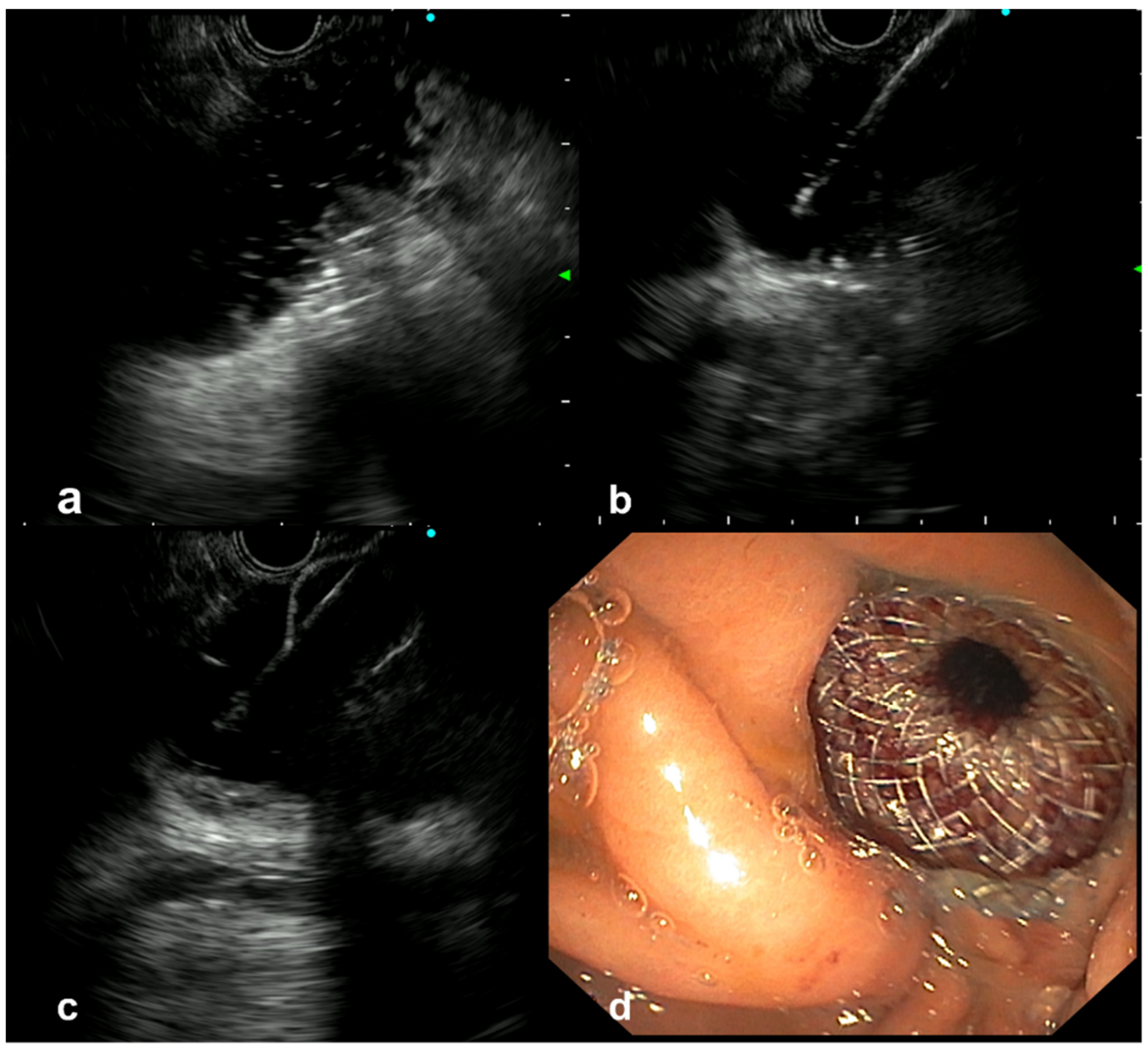 Cancers 14 05516 g001