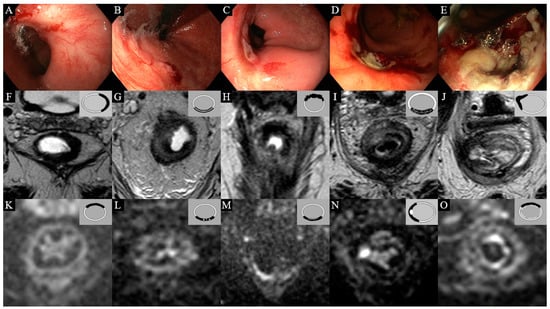 Cancers 14 05565 g001