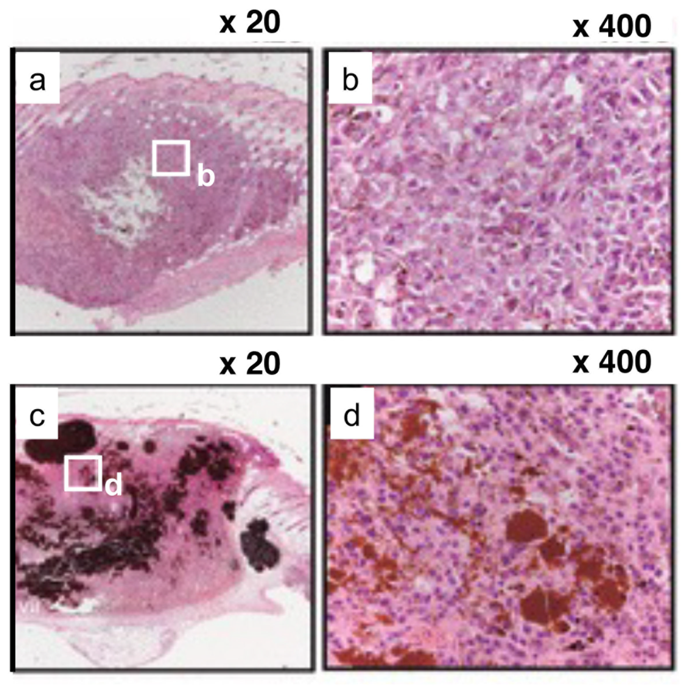 Cancers 14 05588 g006