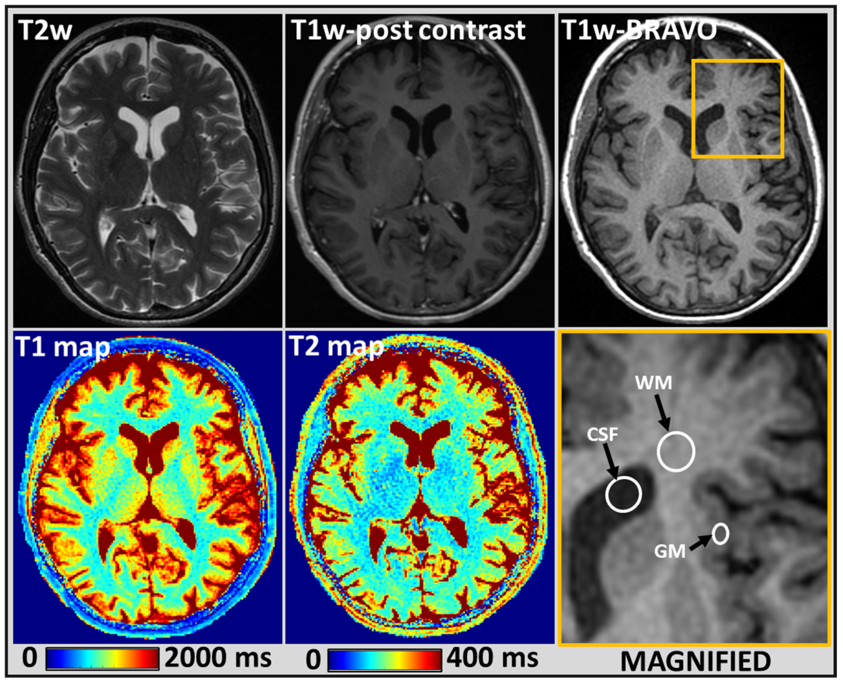 Cancers 14 05606 g001