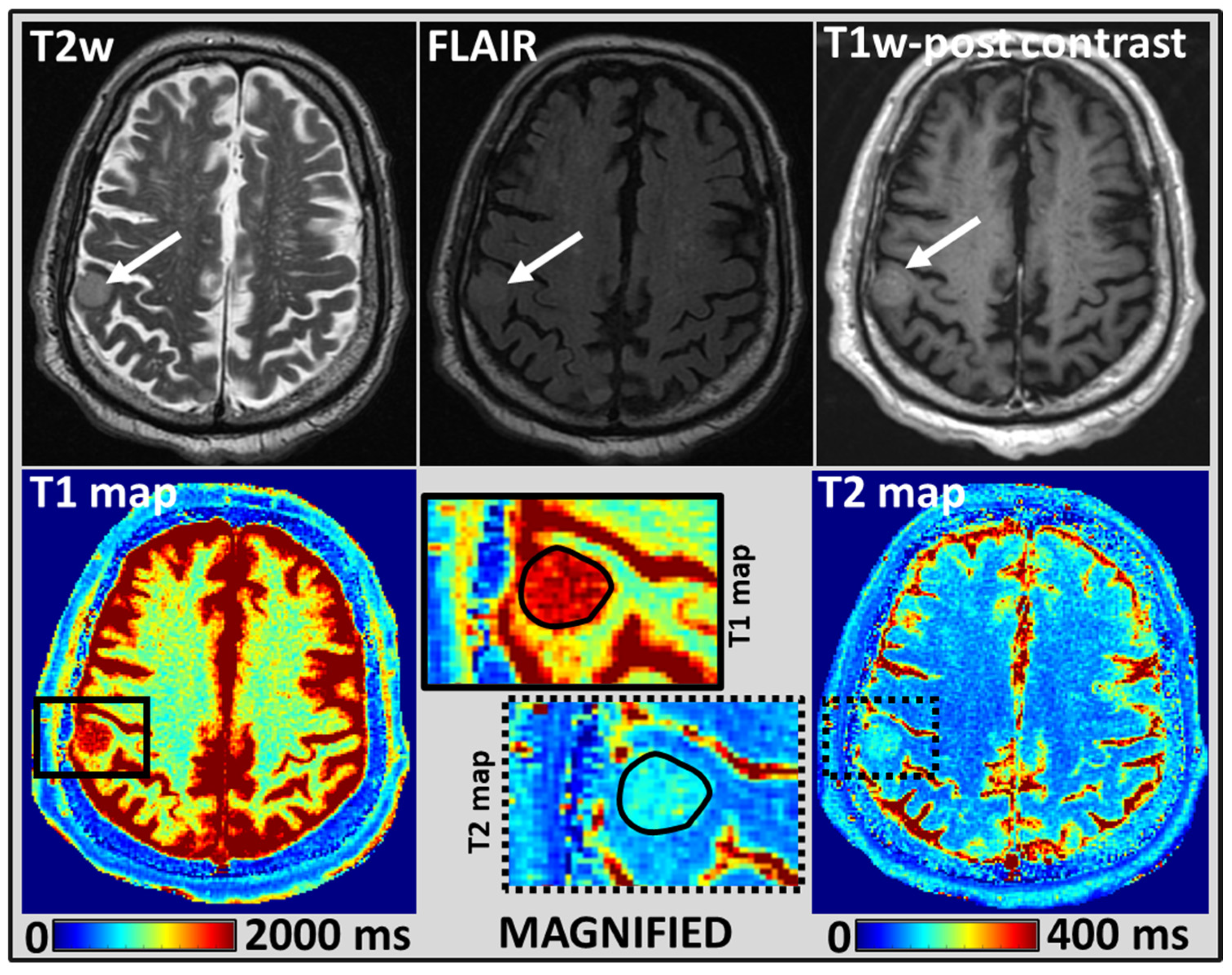 Cancers 14 05606 g002