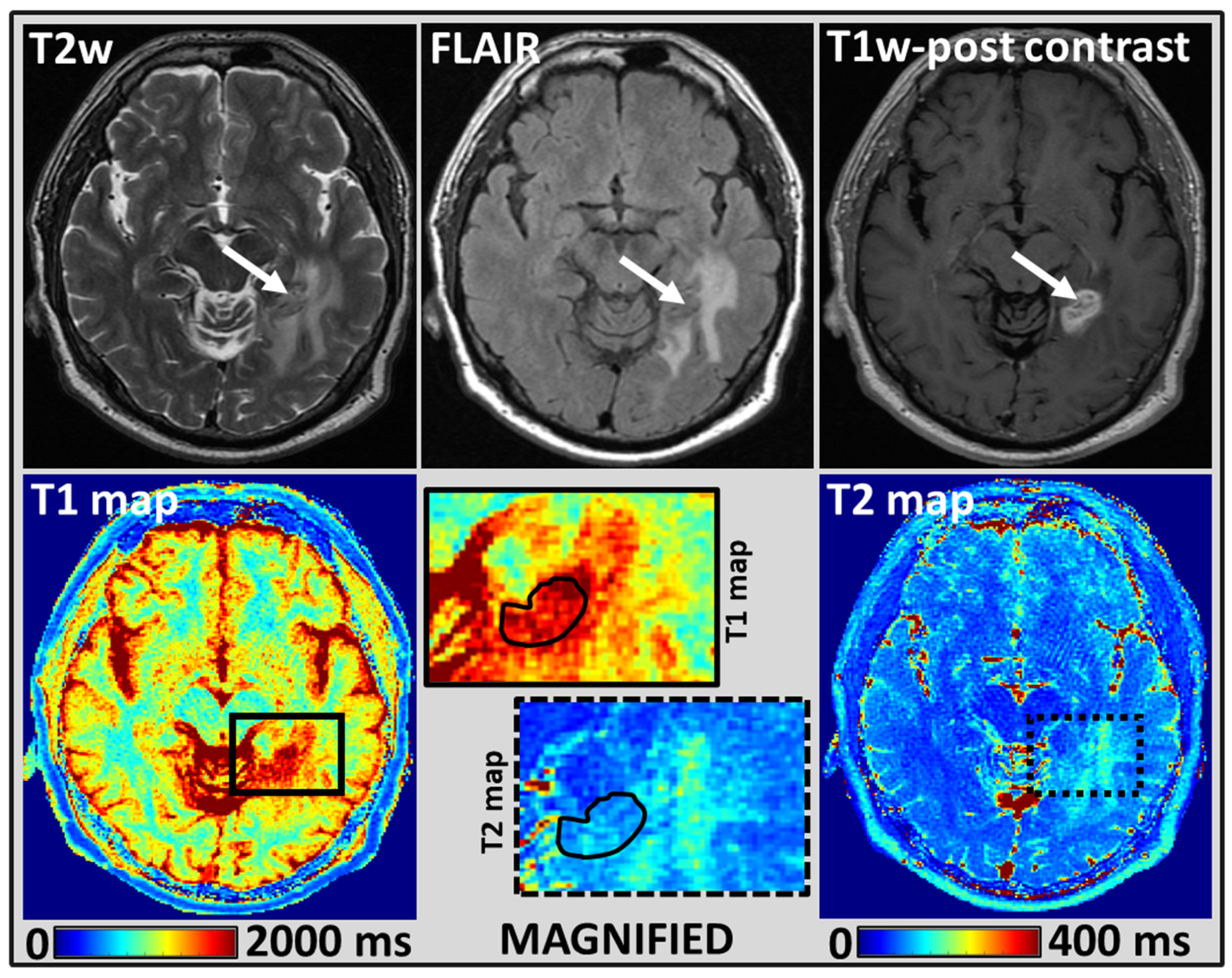 Cancers 14 05606 g003