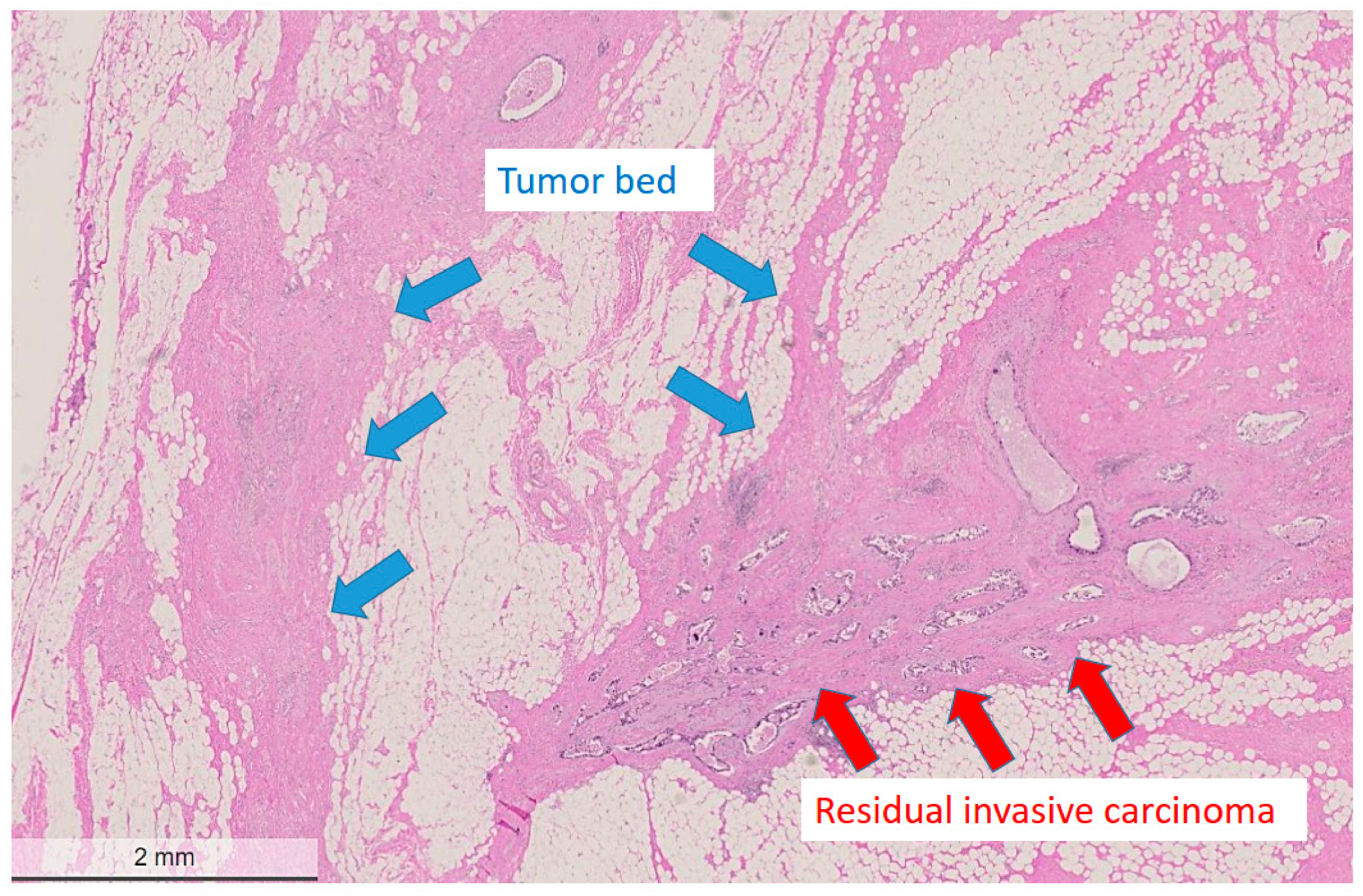 Cancers 14 05609 g001