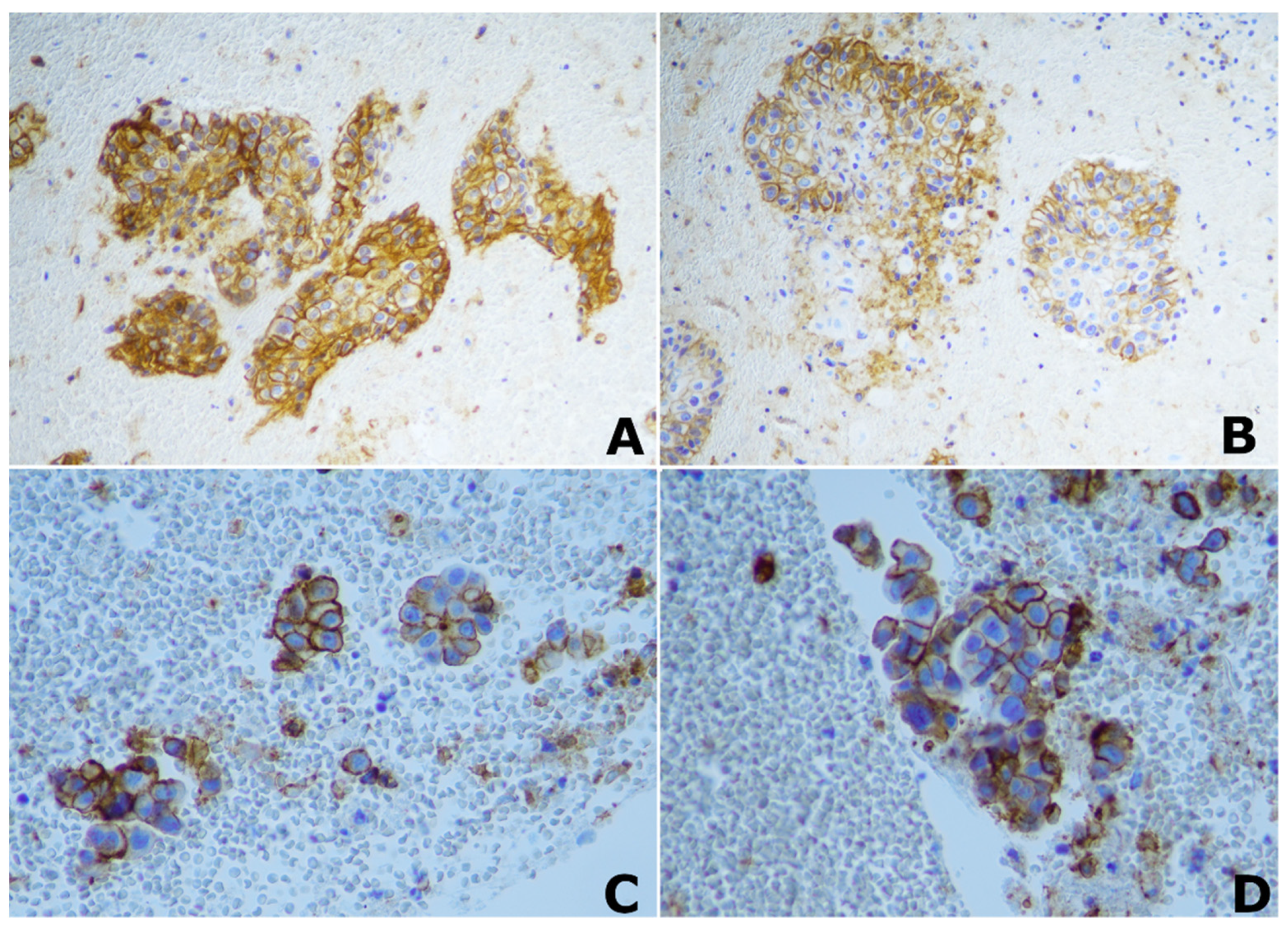 Cancers 14 05634 g001 Cancers 14 05634 g001