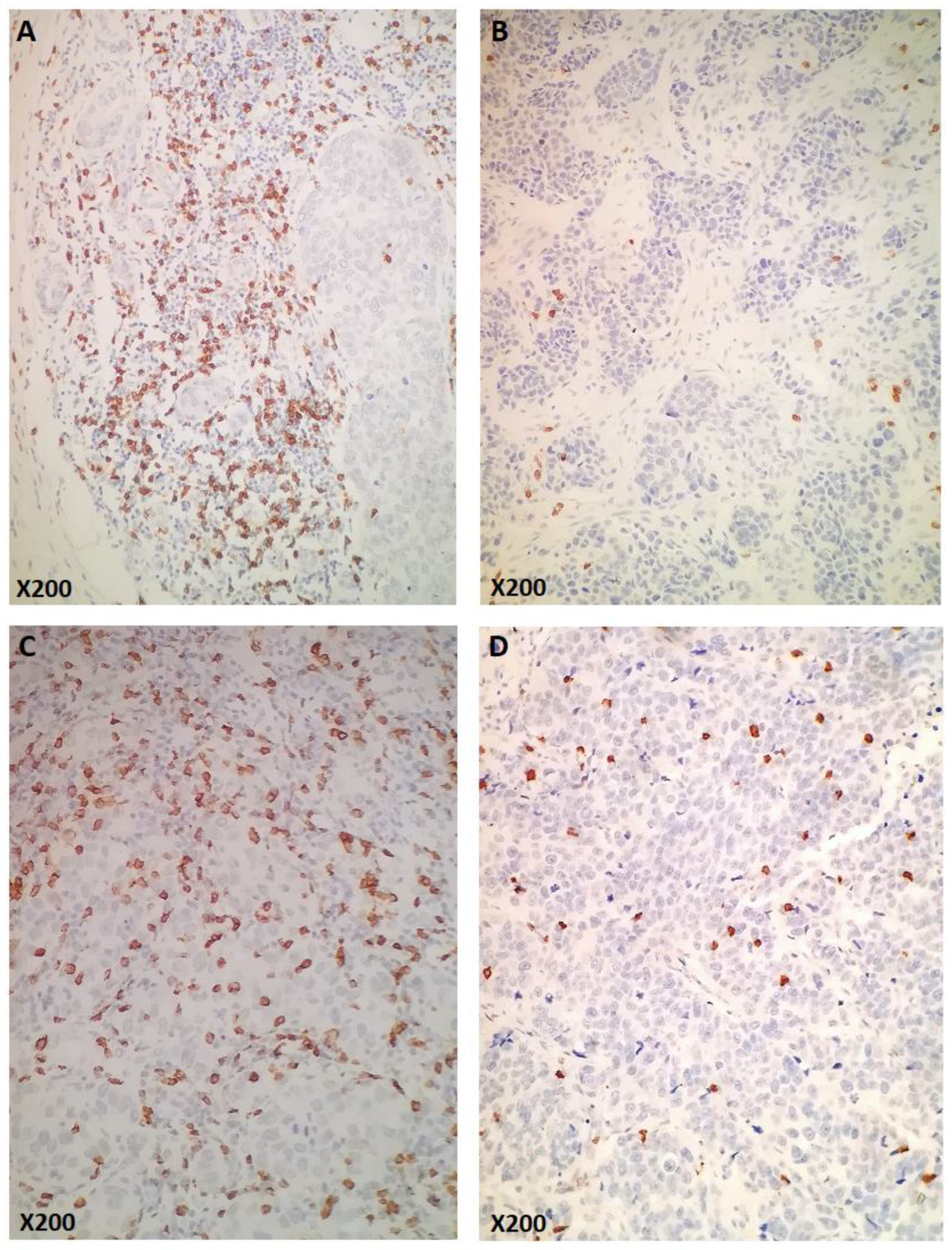 Cancers 14 05635 g002