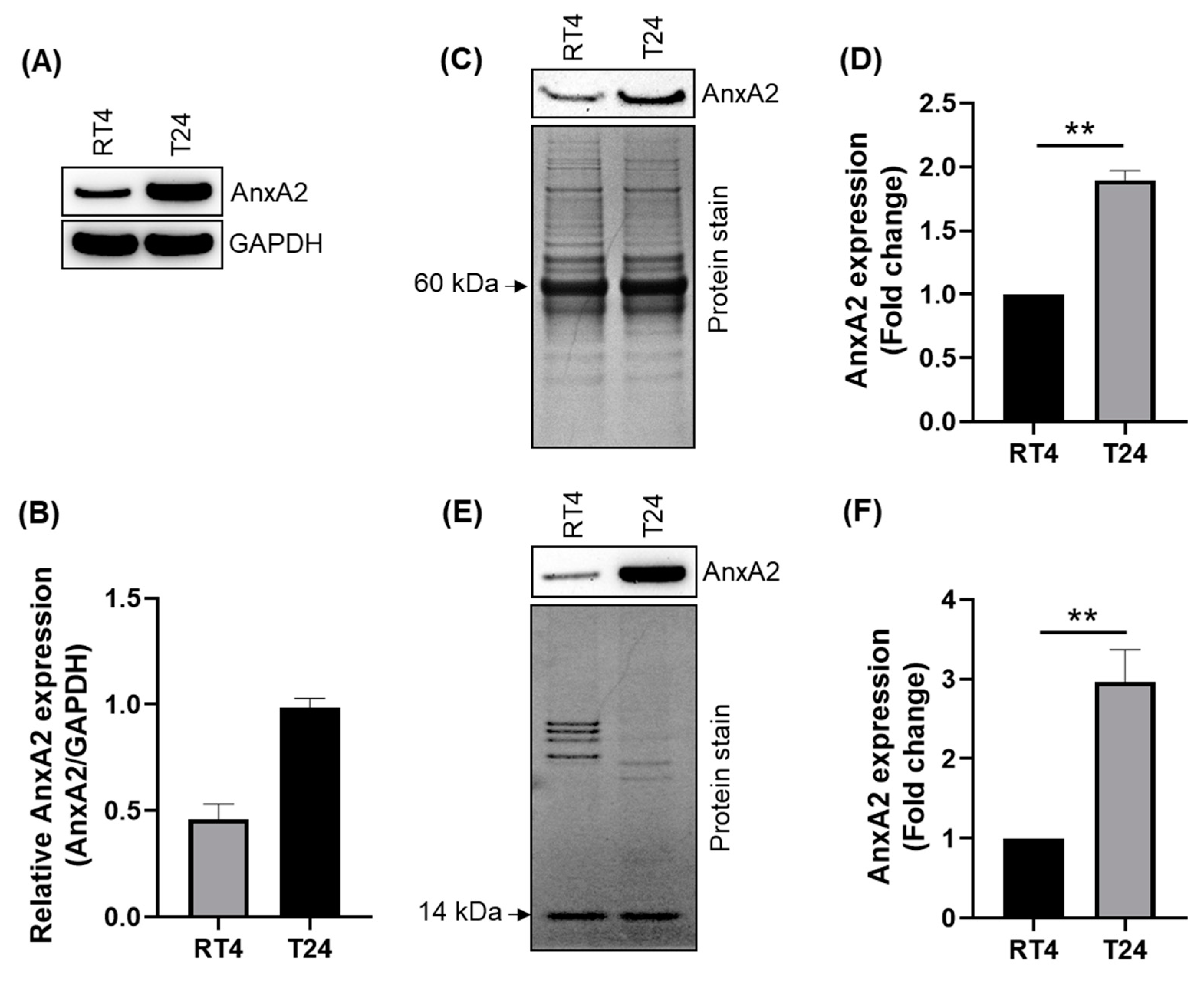 Cancers 14 05664 g003