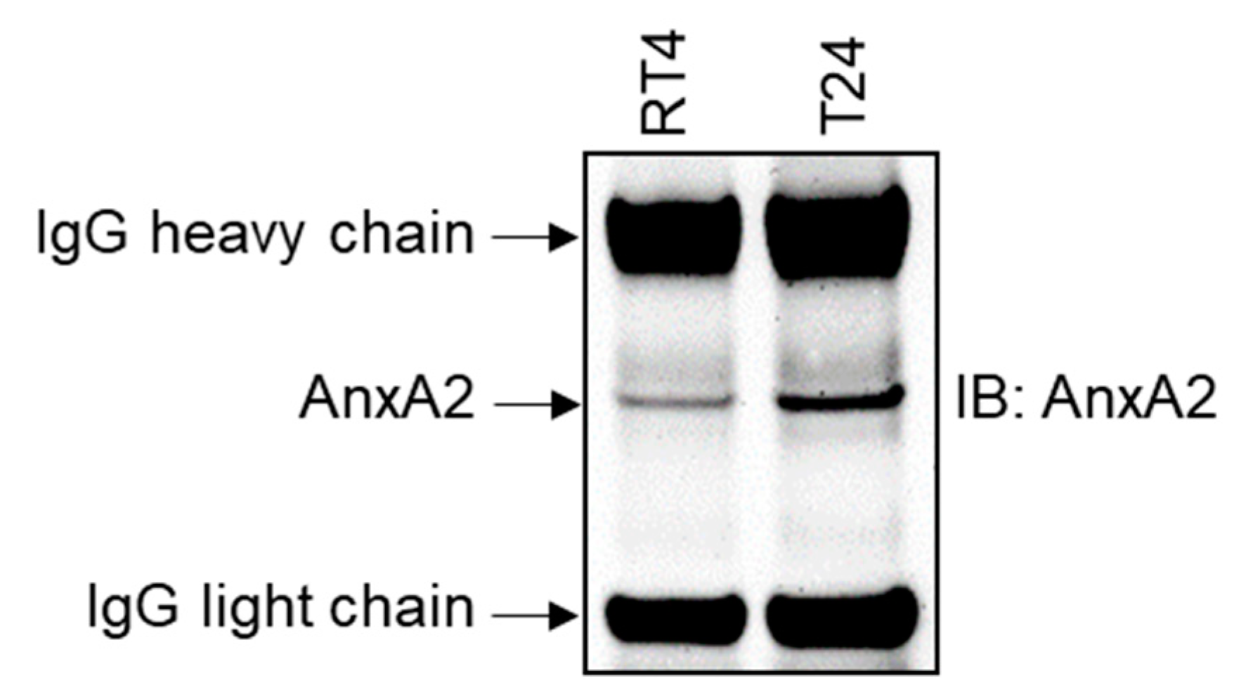 Cancers 14 05664 g005